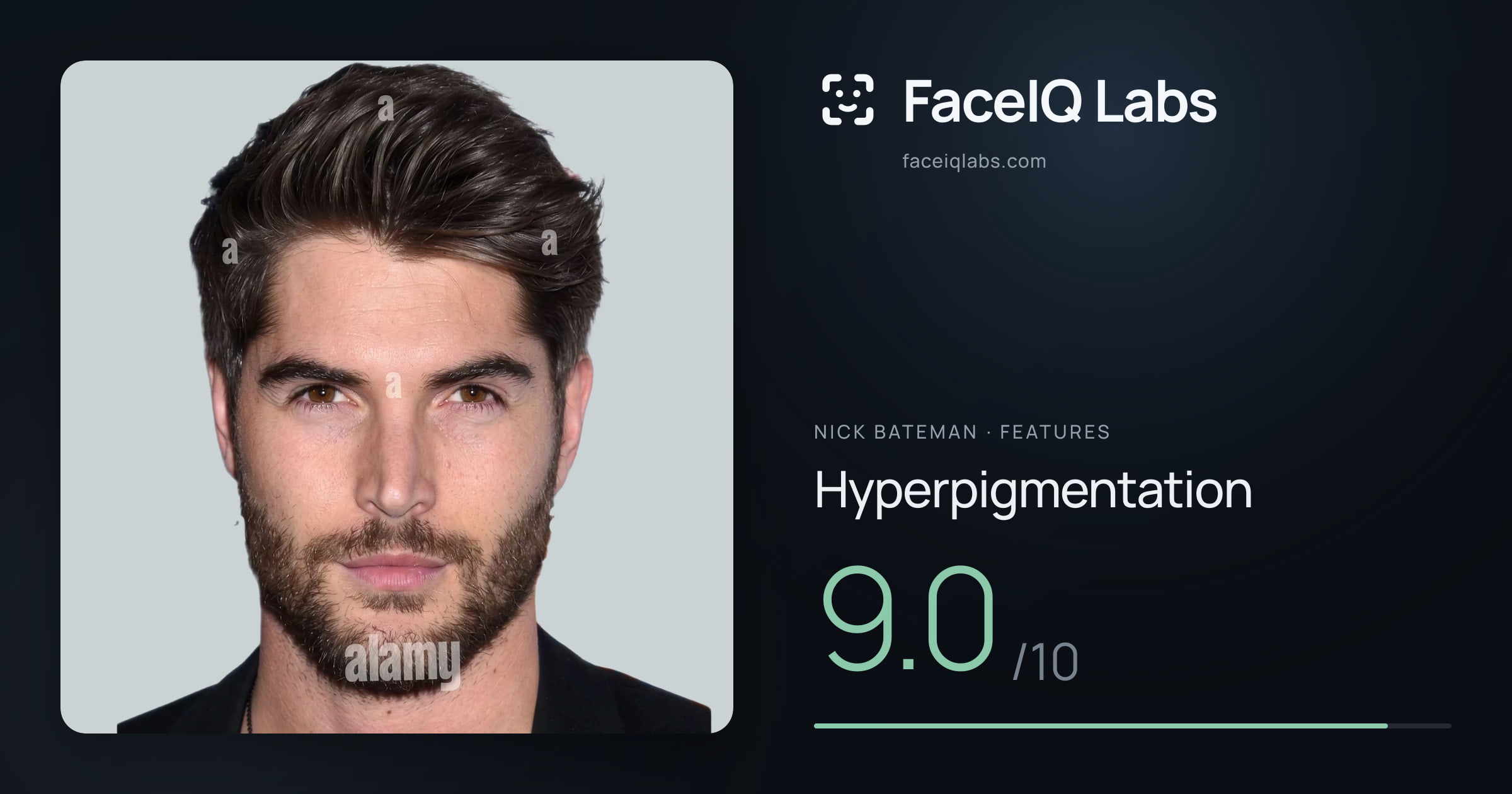 Nick Bateman Hyperpigmentation: 9.0/10, drawn on the photo
