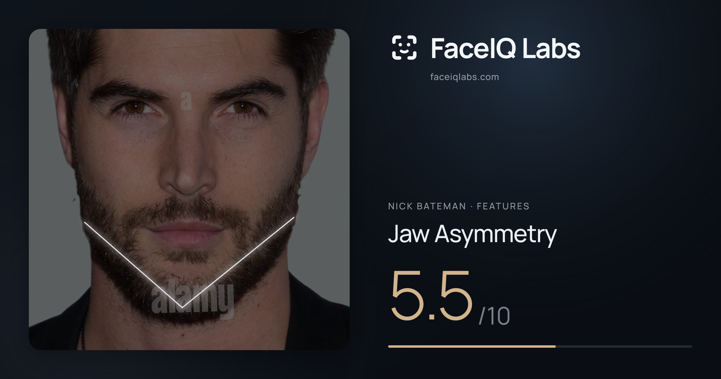 Nick Bateman Jaw Asymmetry: 5.5/10, drawn on the photo