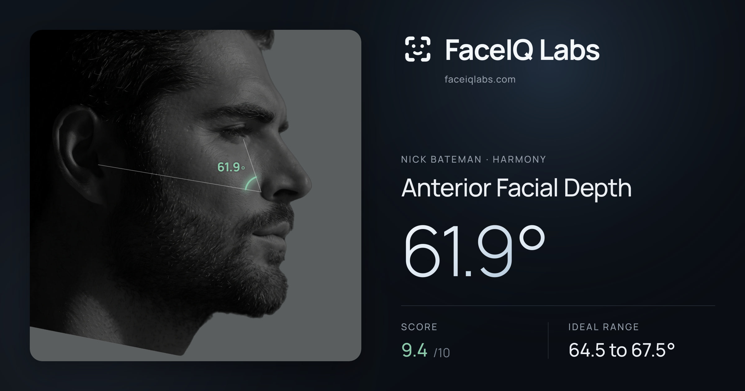Nick Bateman Anterior Facial Depth: 61.9°, drawn on the photo