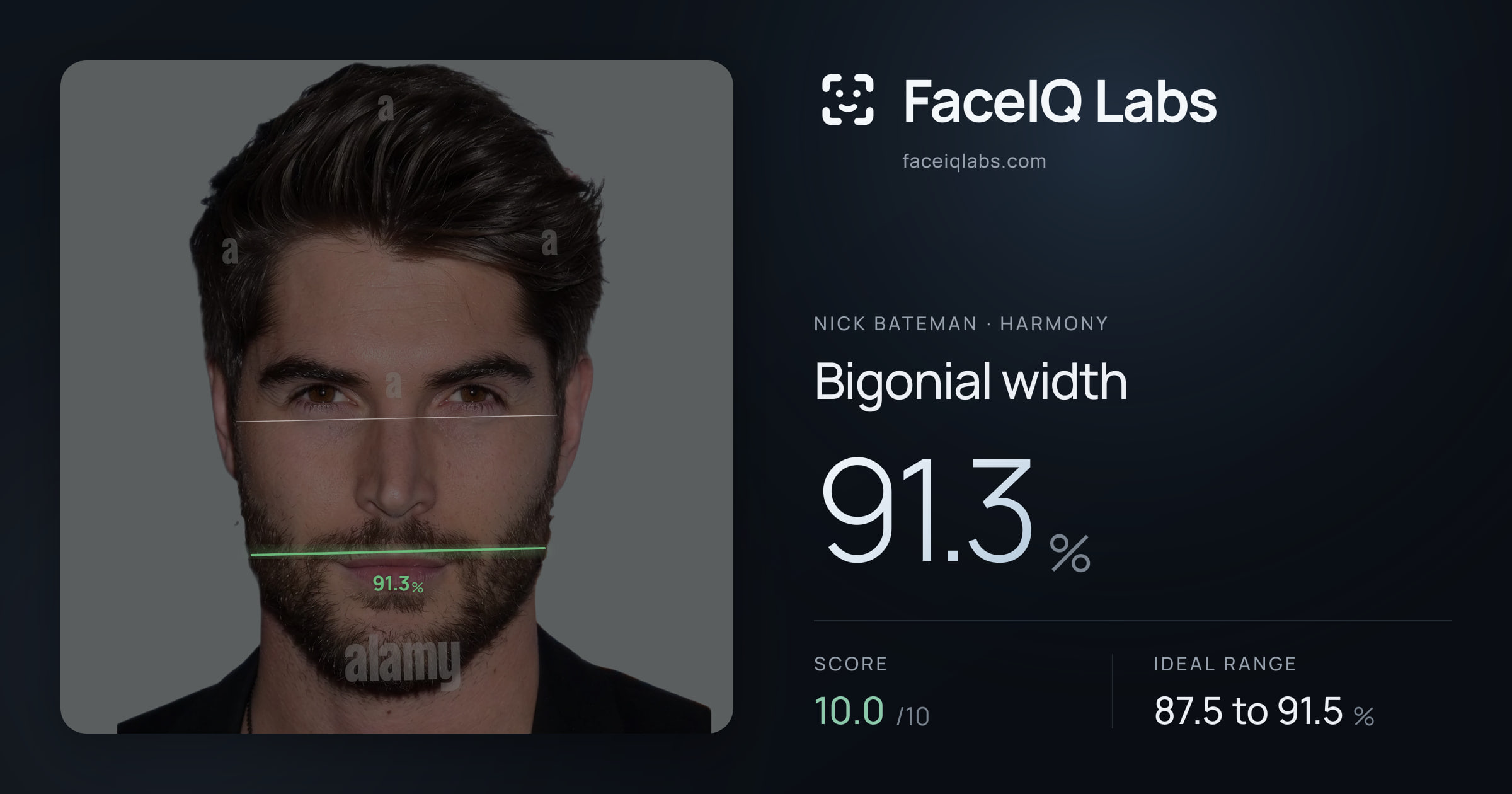 Nick Bateman Bigonial width: 92.1%, drawn on the photo