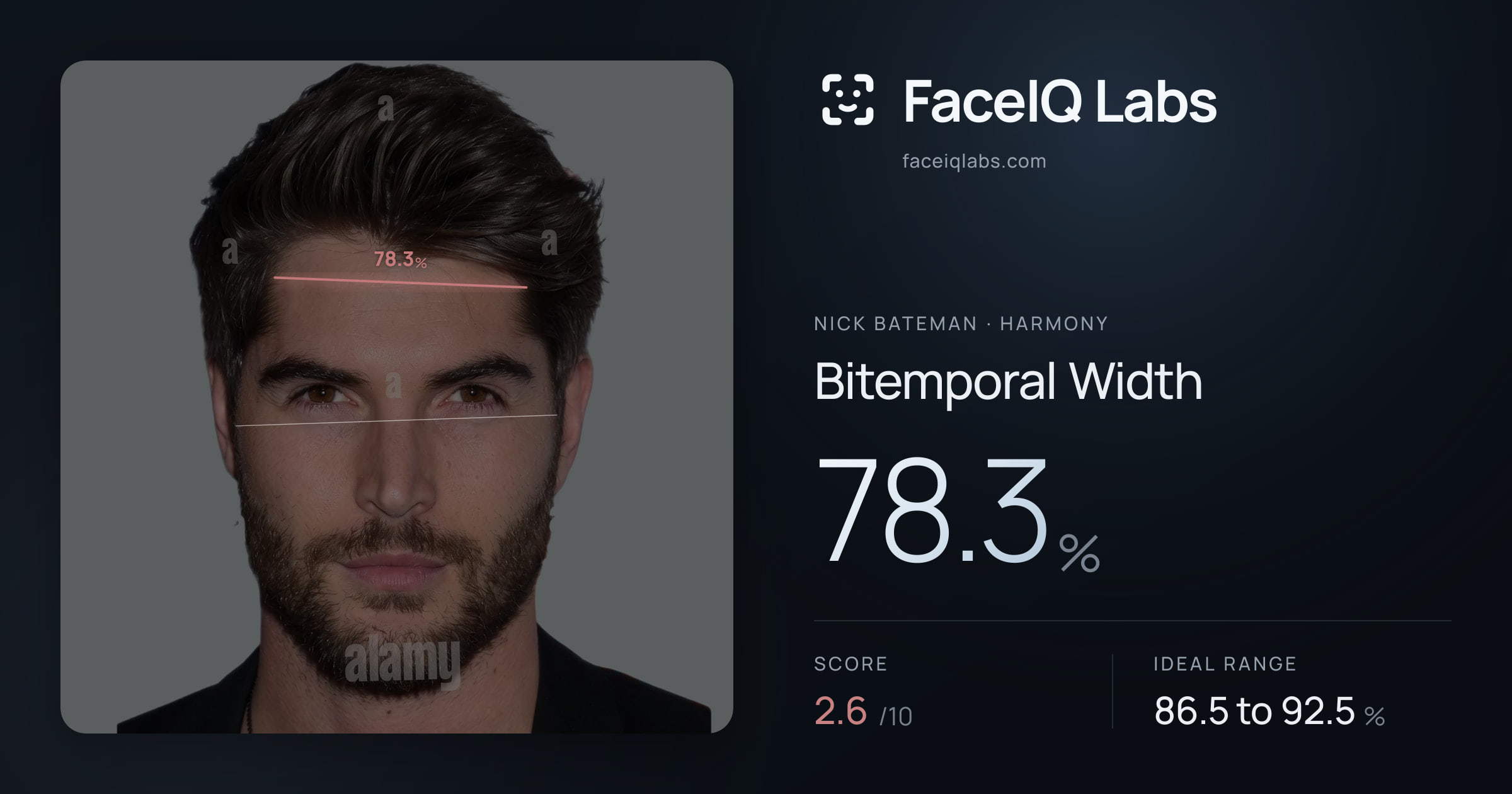 Nick Bateman Bitemporal Width: 78.3%, drawn on the photo