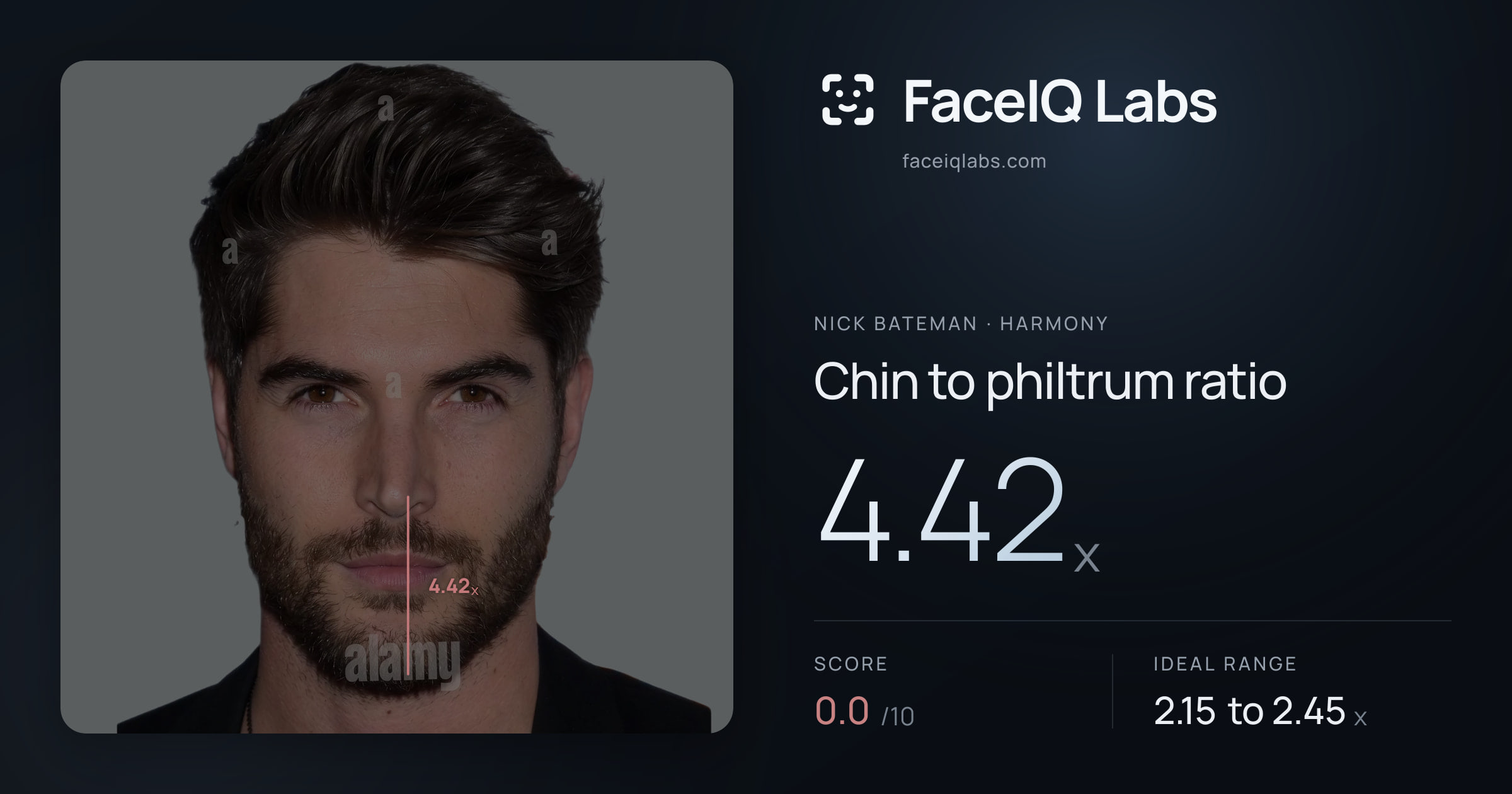 Nick Bateman Chin to philtrum ratio: 4.42x, drawn on the photo