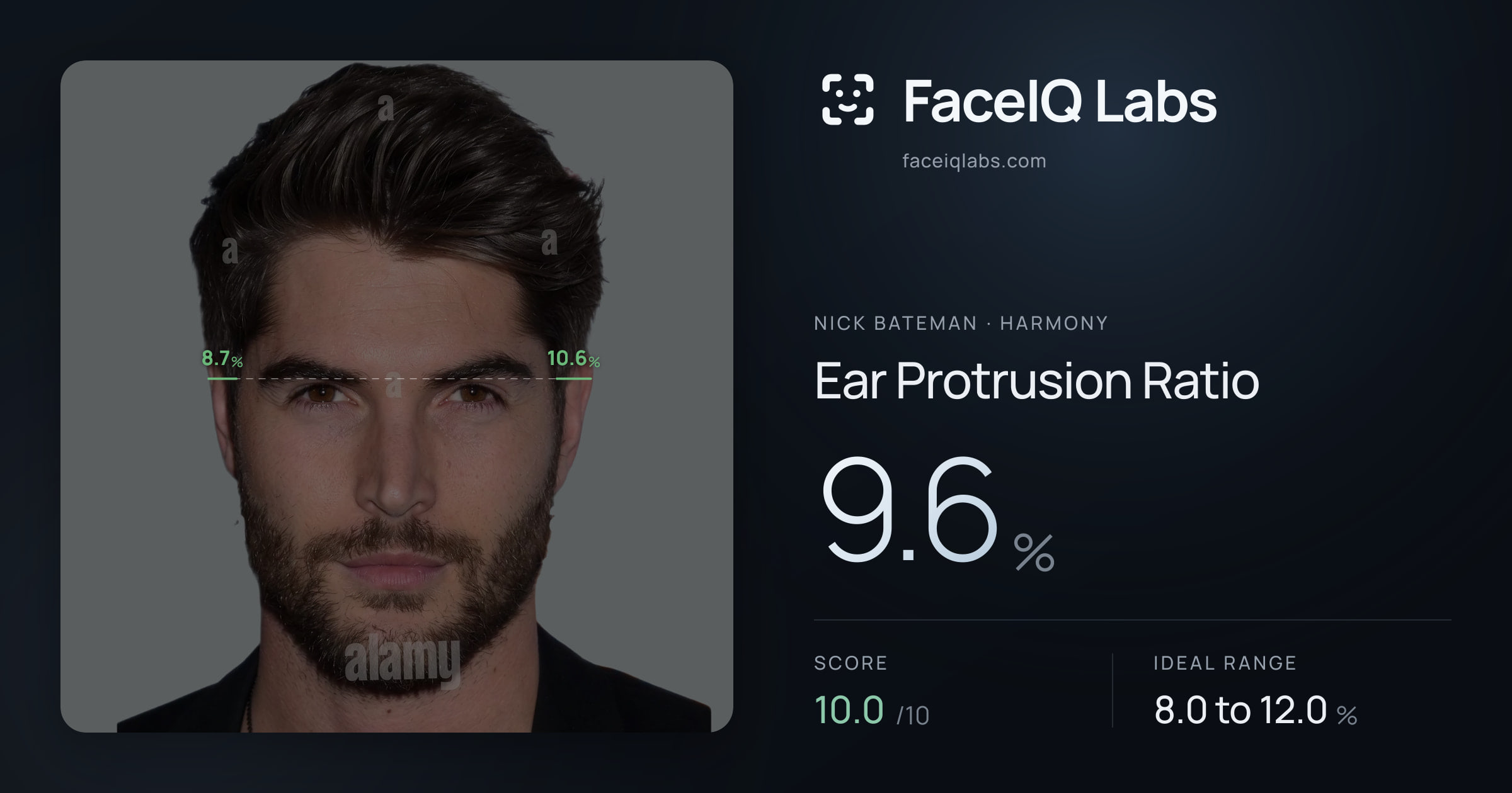 Nick Bateman Ear Protrusion Ratio: 30.2%, drawn on the photo