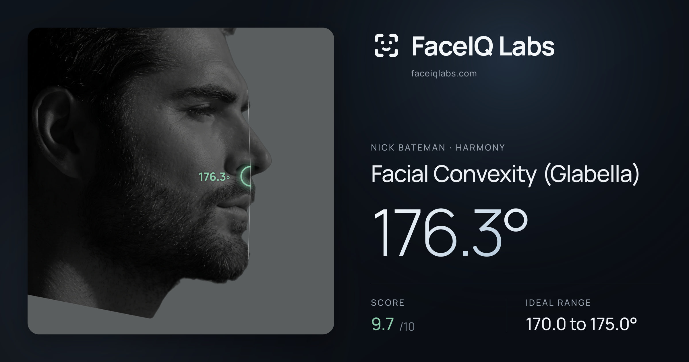 Nick Bateman Facial Convexity (Glabella): 176.3°, drawn on the photo
