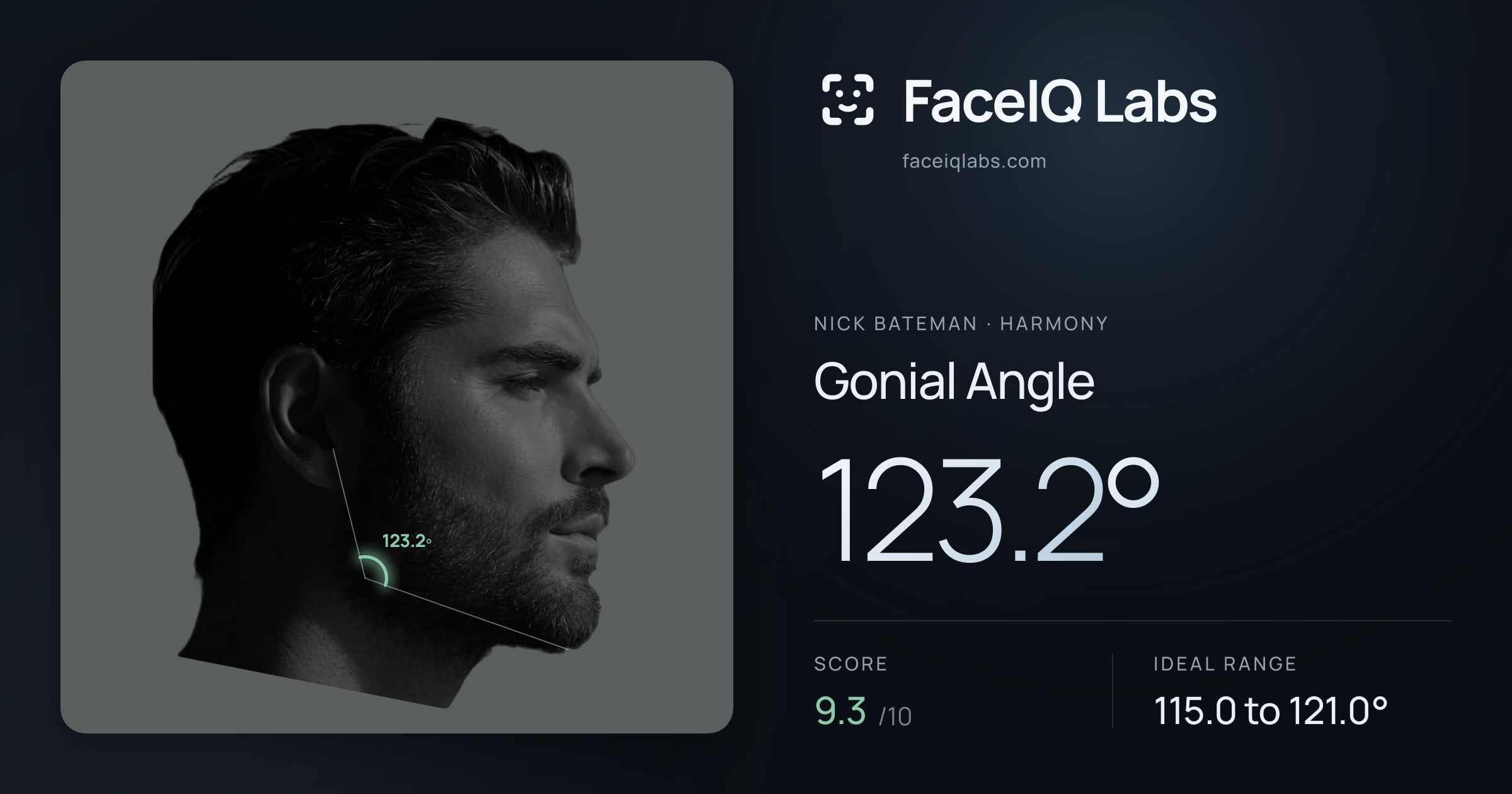 Nick Bateman Gonial Angle: 124.1°, drawn on the photo