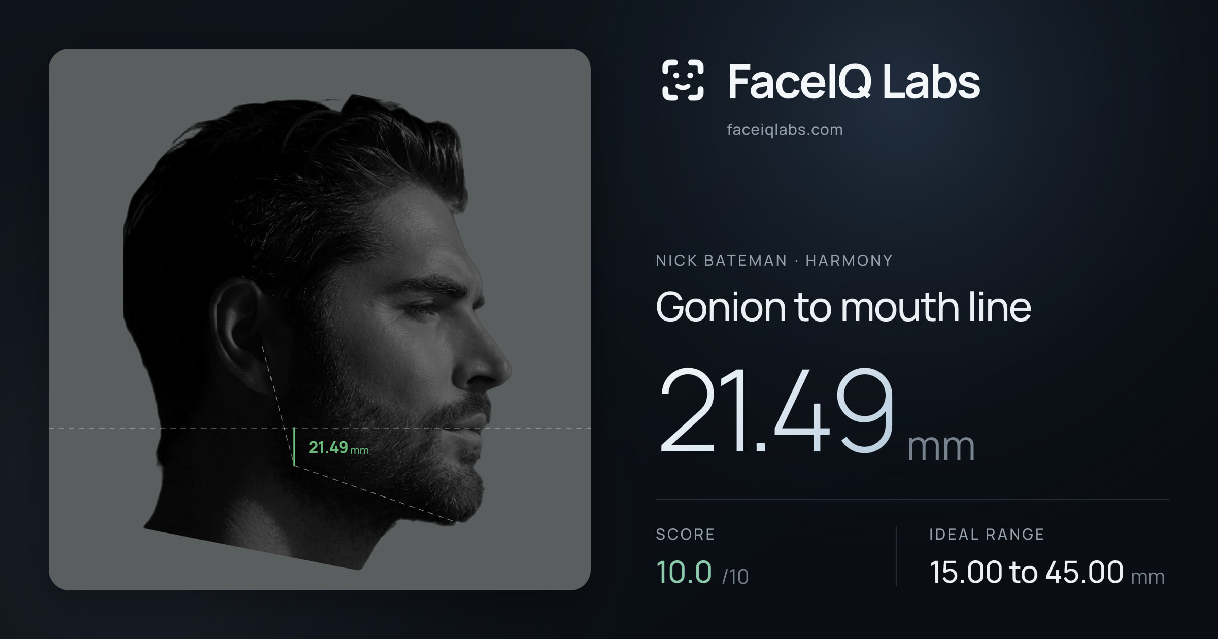 Nick Bateman Gonion to mouth line: 21.49mm, drawn on the photo