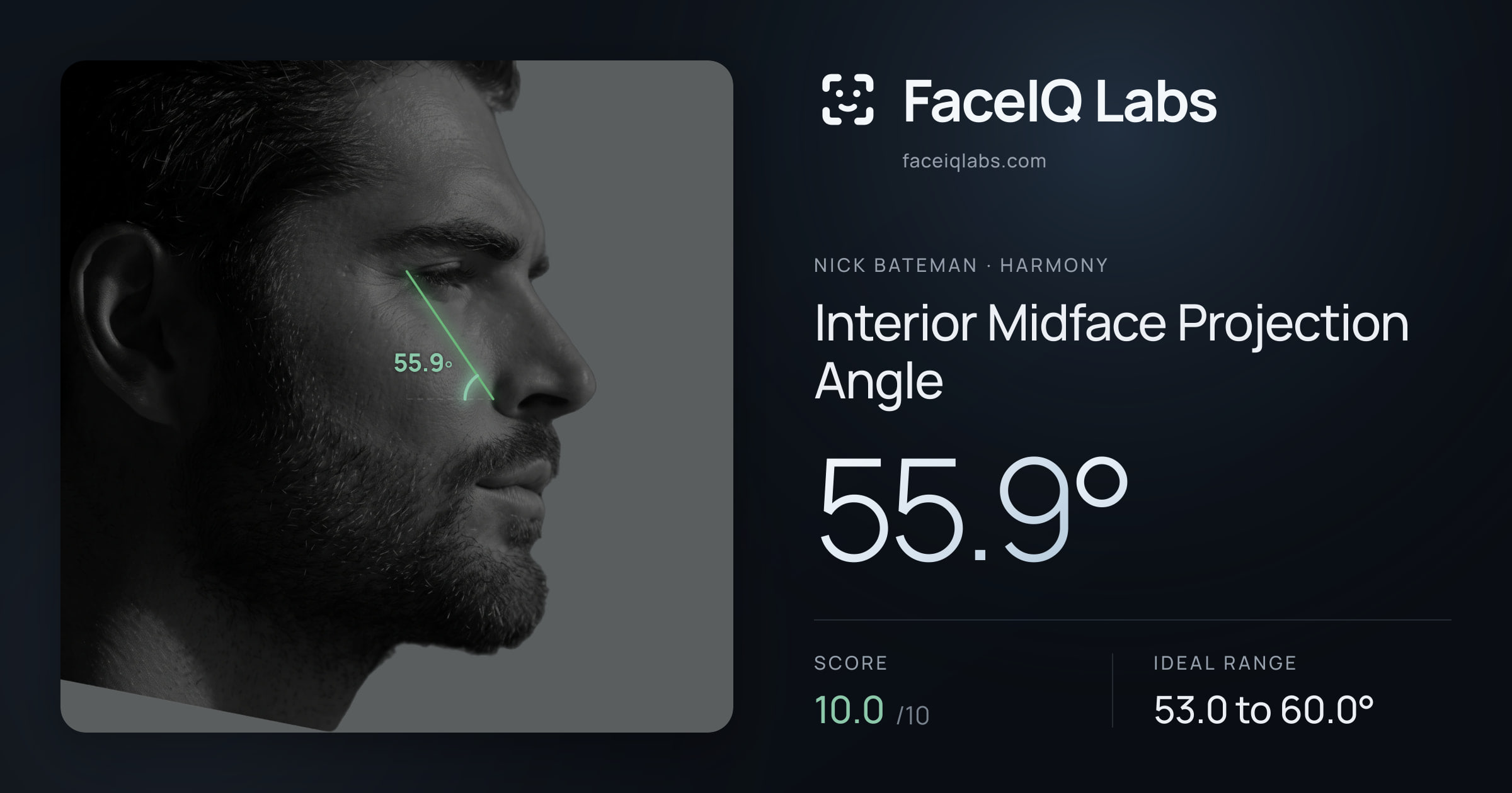 Nick Bateman Interior Midface Projection Angle: 55.9°, drawn on the photo