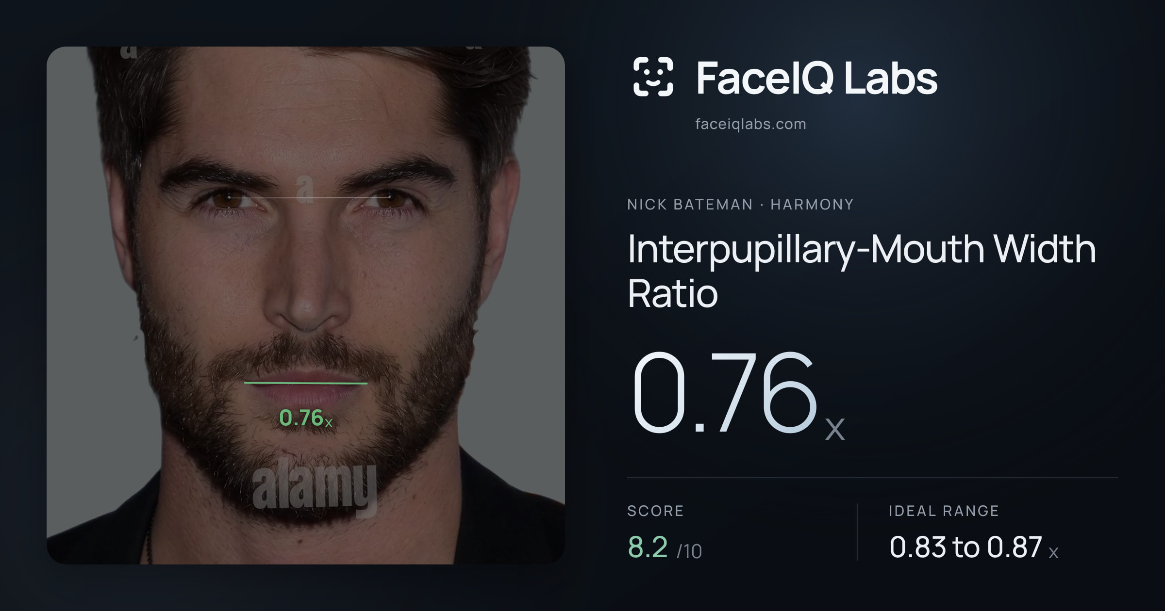 Nick Bateman Interpupillary-Mouth Width Ratio: 0.76x, drawn on the photo