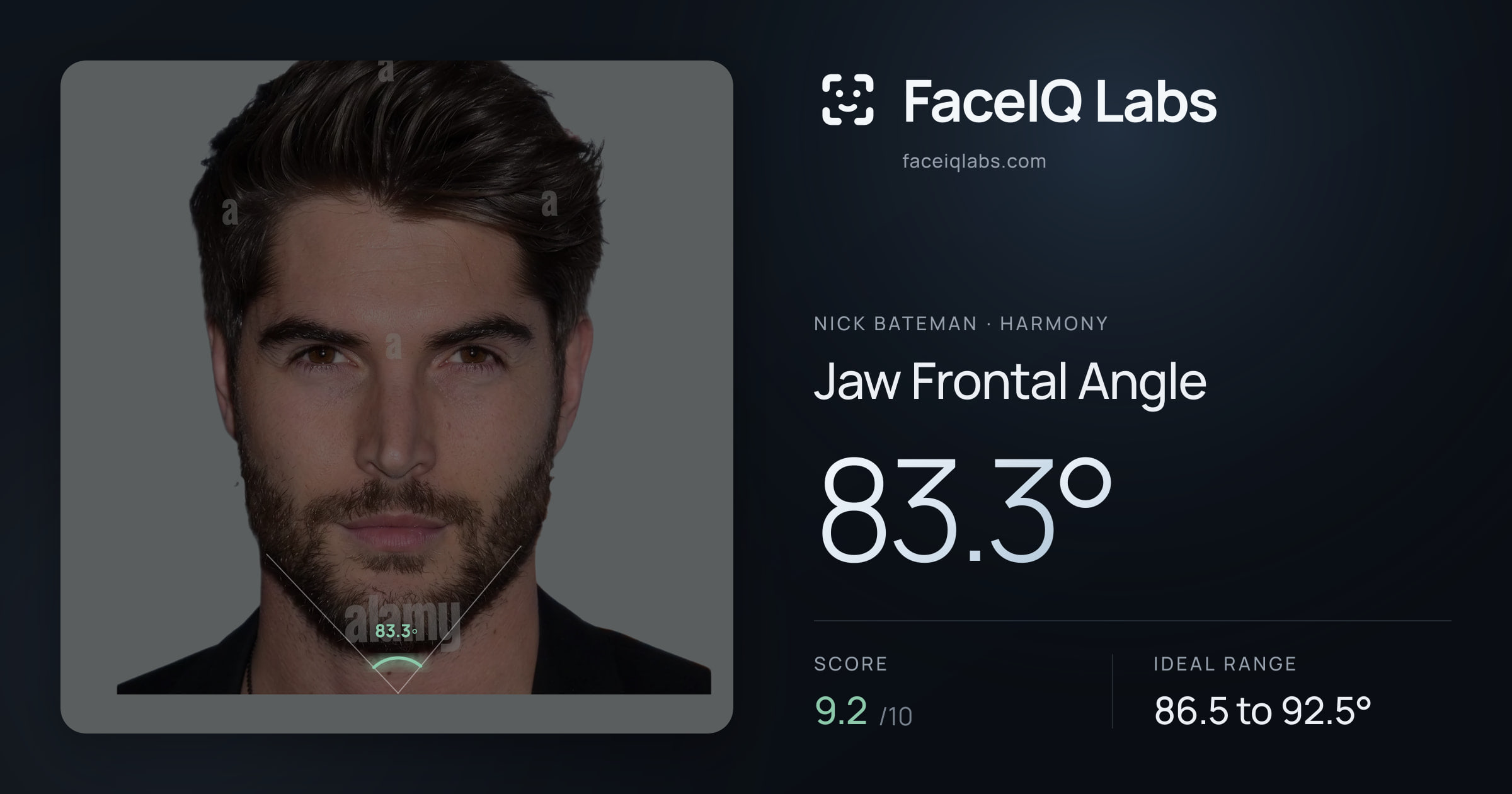 Nick Bateman Jaw Frontal Angle: 86.2°, drawn on the photo