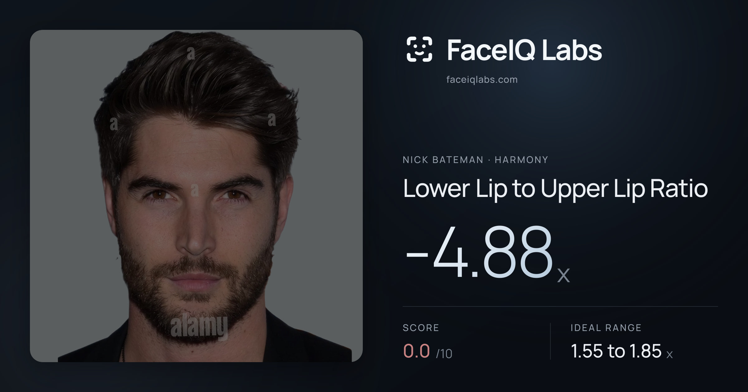 Nick Bateman Lower Lip to Upper Lip Ratio: -4.88x, drawn on the photo