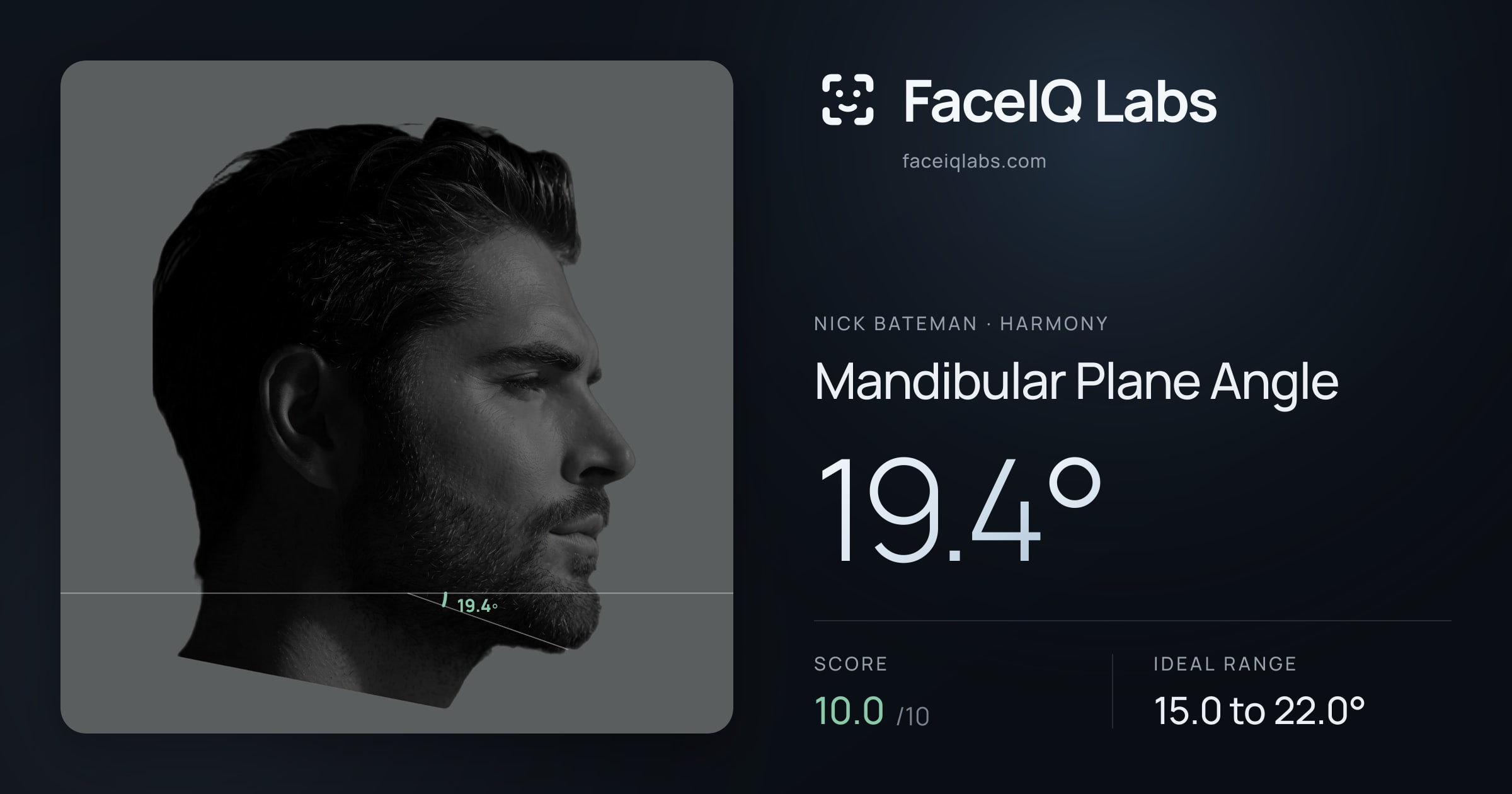 Nick Bateman Mandibular Plane Angle: 20.2°, drawn on the photo