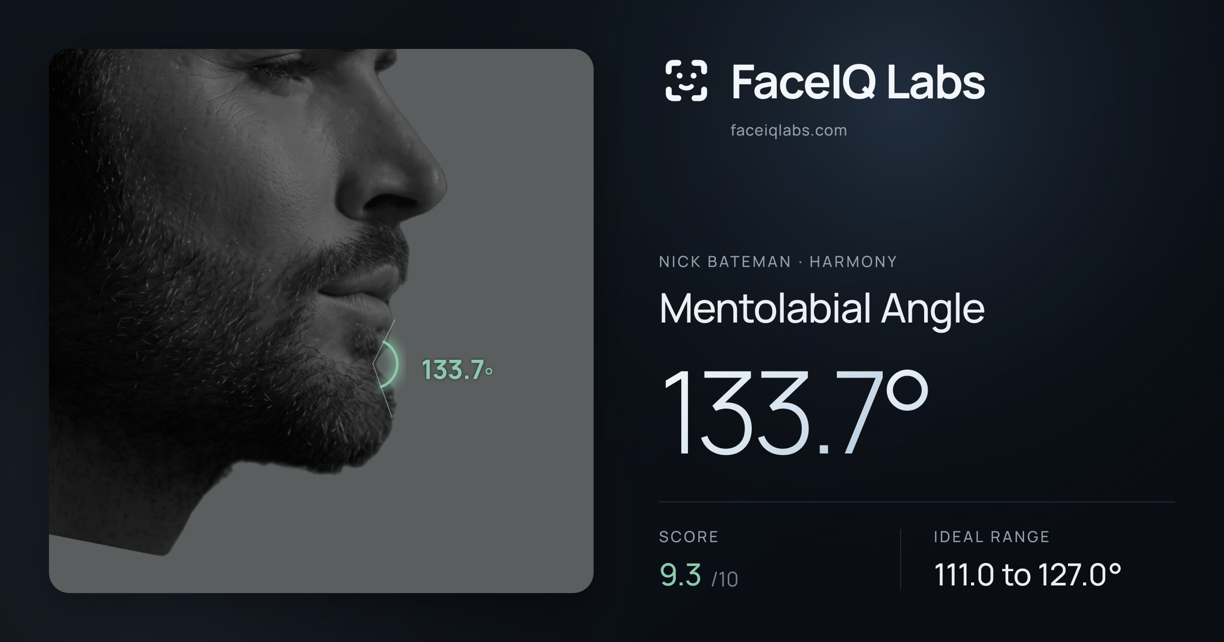 Nick Bateman Mentolabial Angle: 133.7°, drawn on the photo