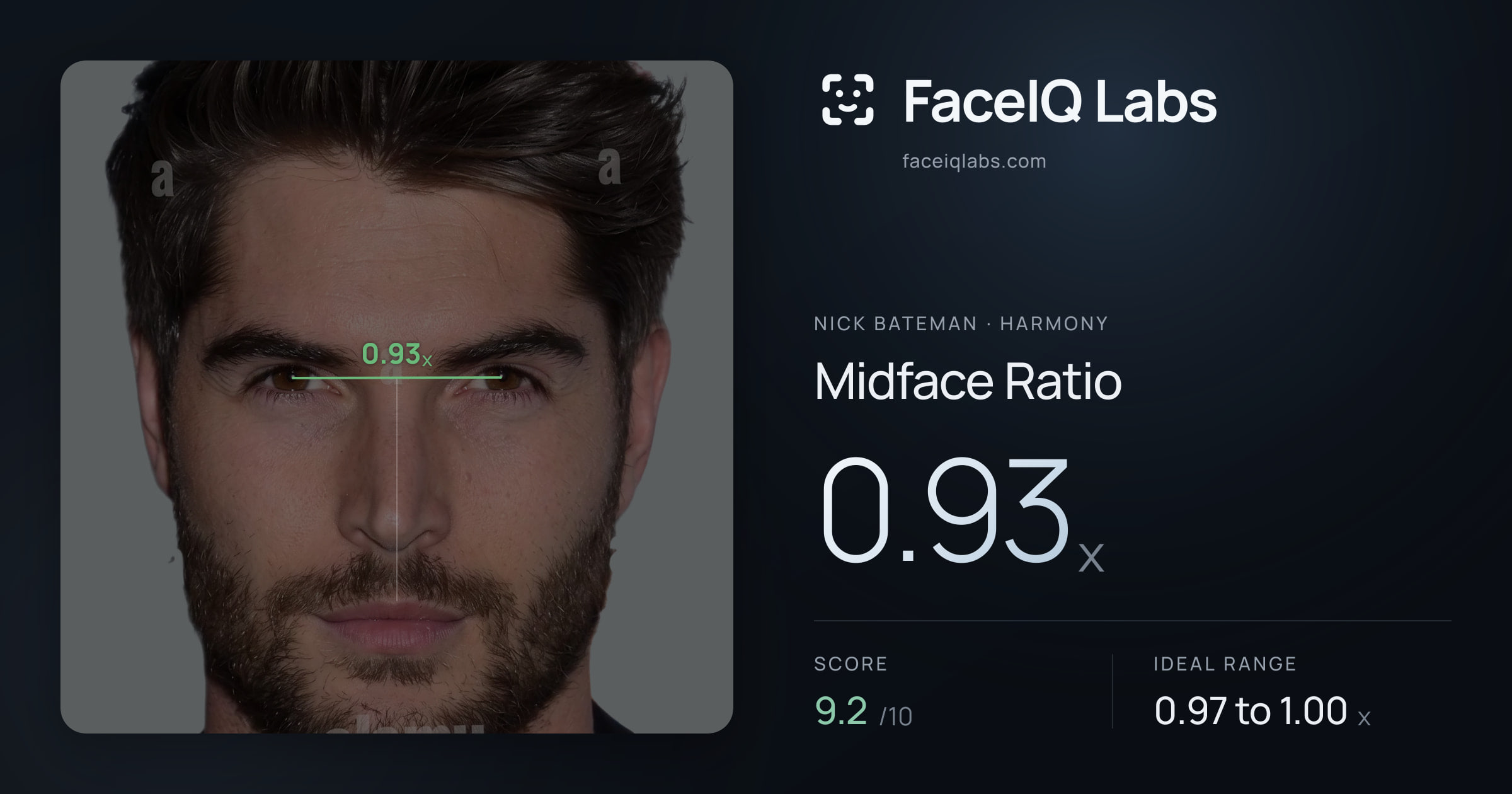 Nick Bateman Midface Ratio: 0.93x, drawn on the photo