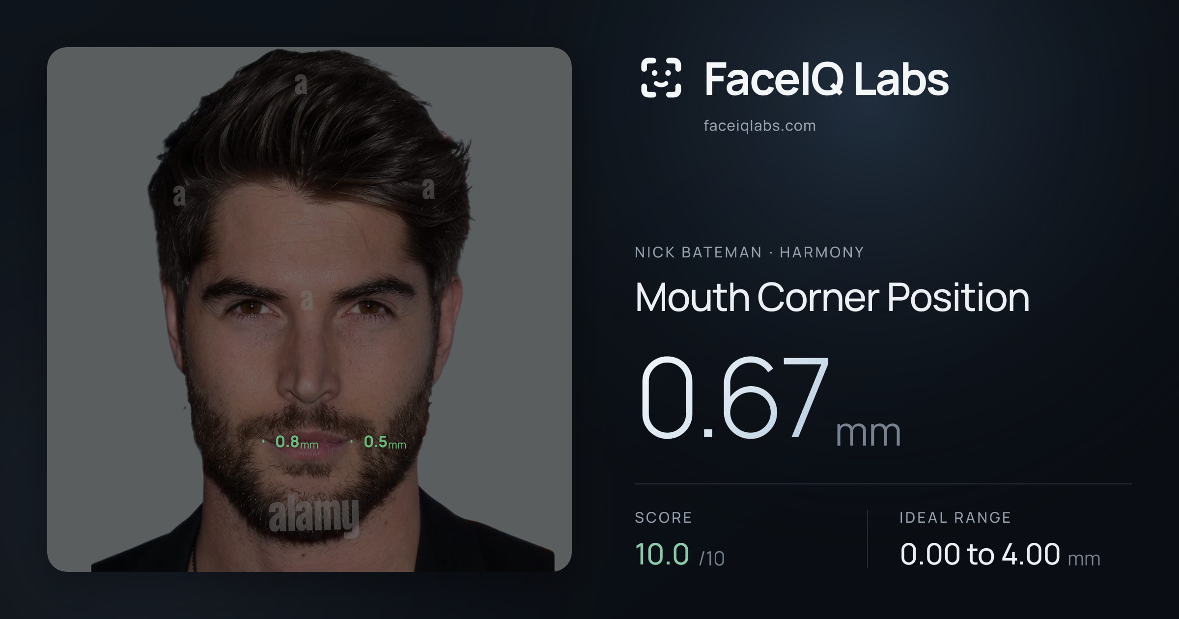 Nick Bateman Mouth Corner Position: 0.67mm, drawn on the photo