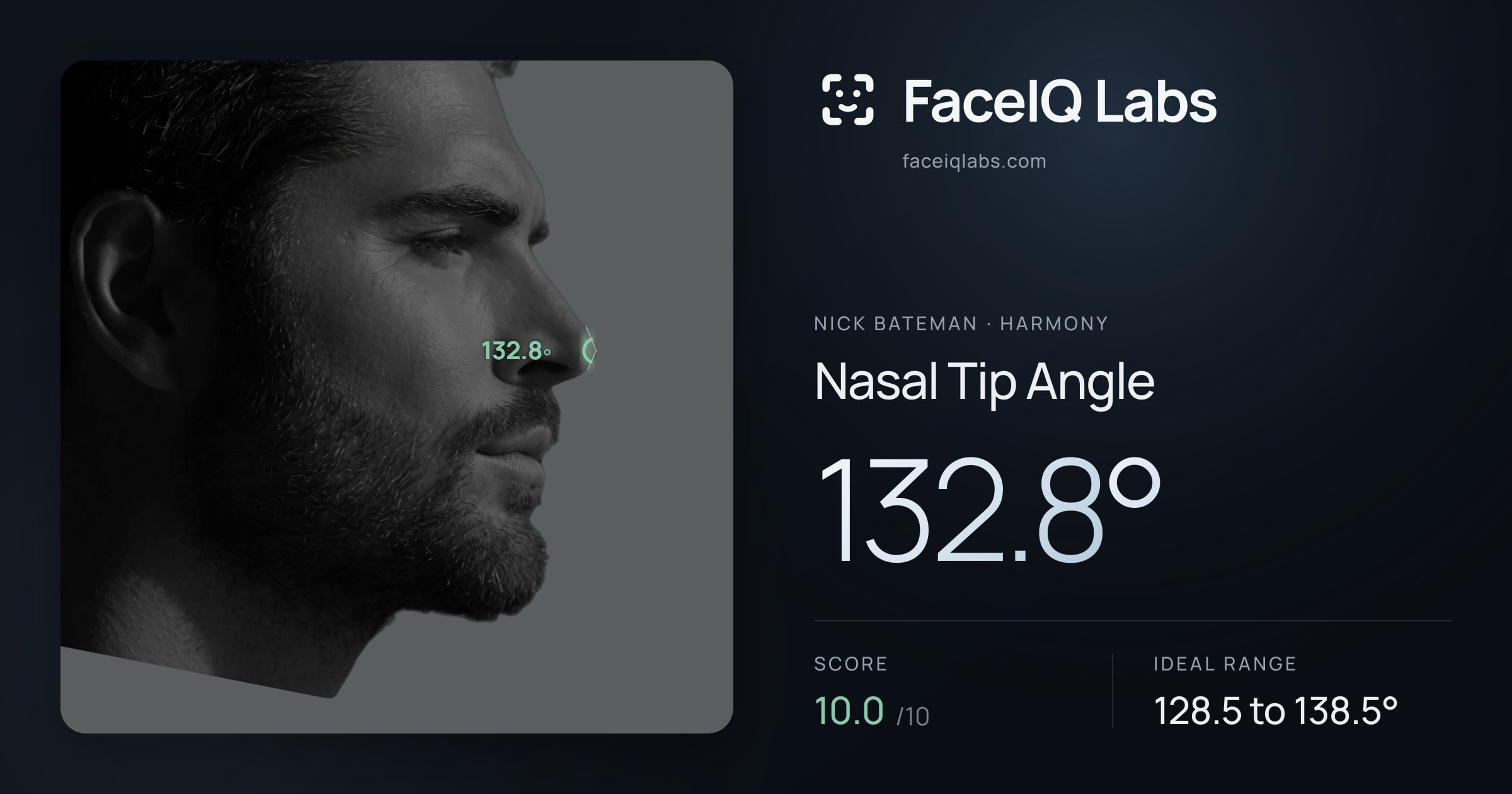 Nick Bateman Nasal Tip Angle: 132.8°, drawn on the photo