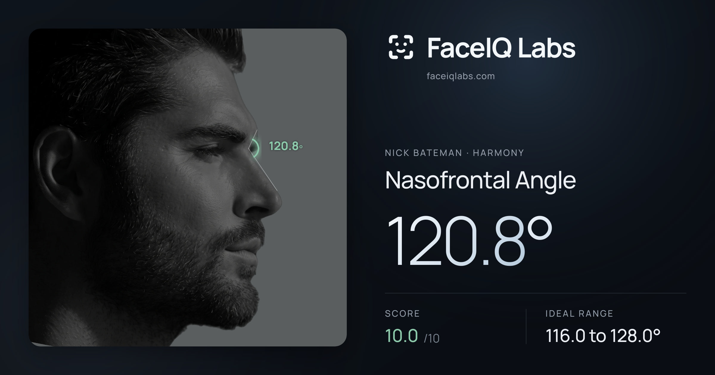 Nick Bateman Nasofrontal Angle: 120.8°, drawn on the photo