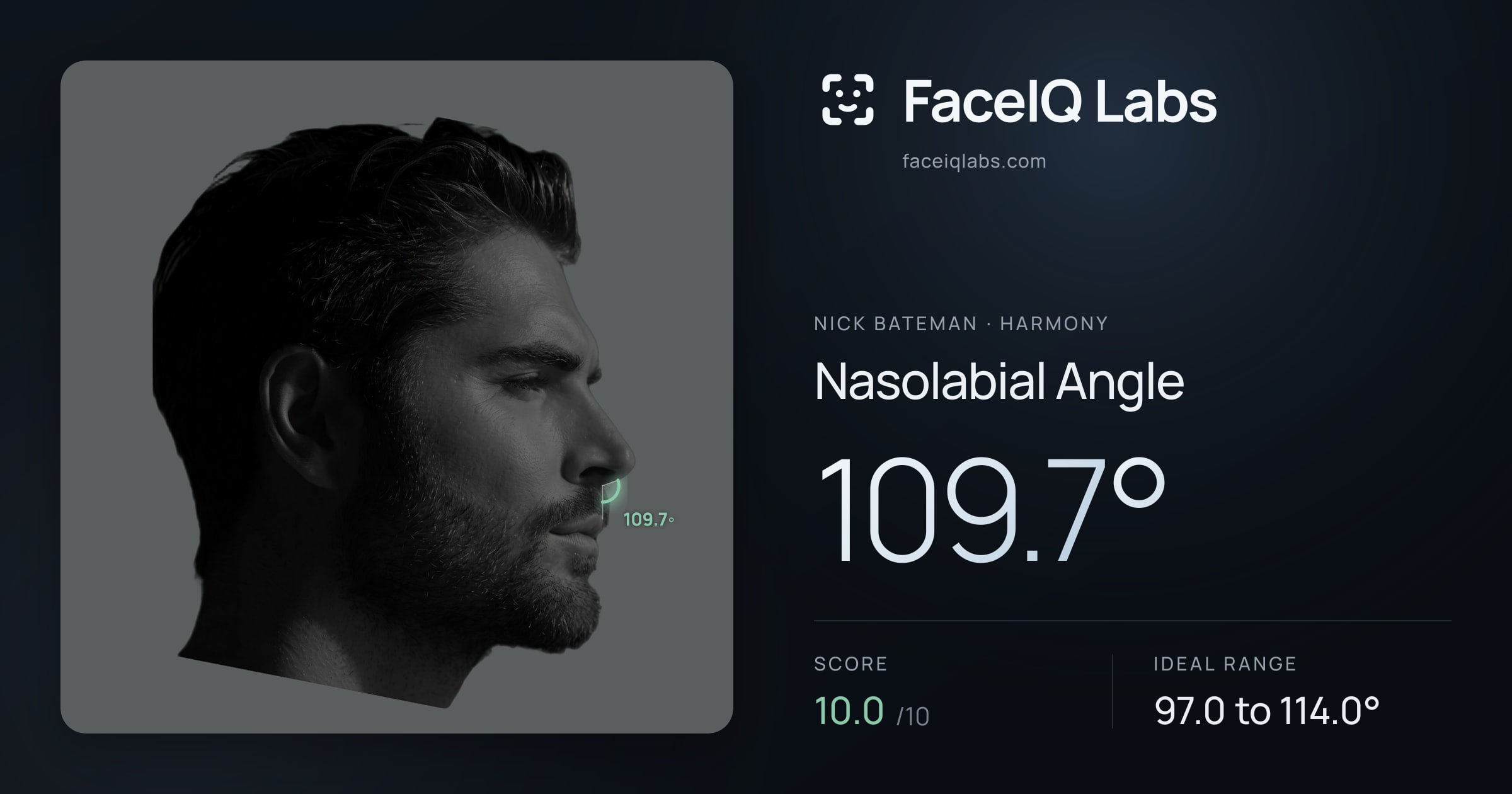 Nick Bateman Nasolabial Angle: 105.4°, drawn on the photo