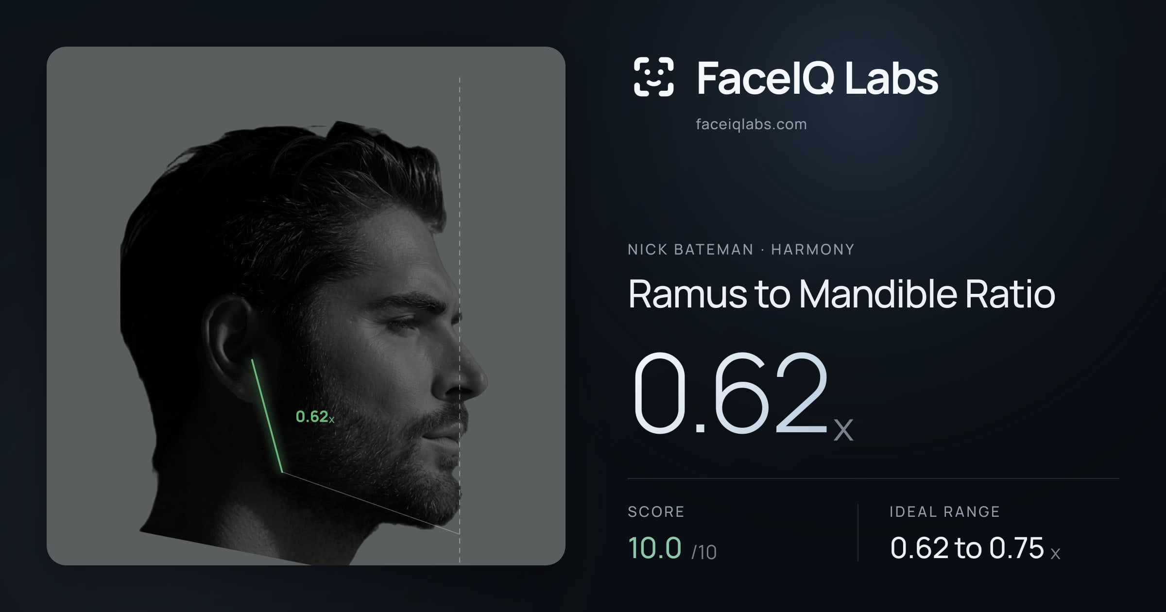 Nick Bateman Ramus to Mandible Ratio: 0.62x, drawn on the photo