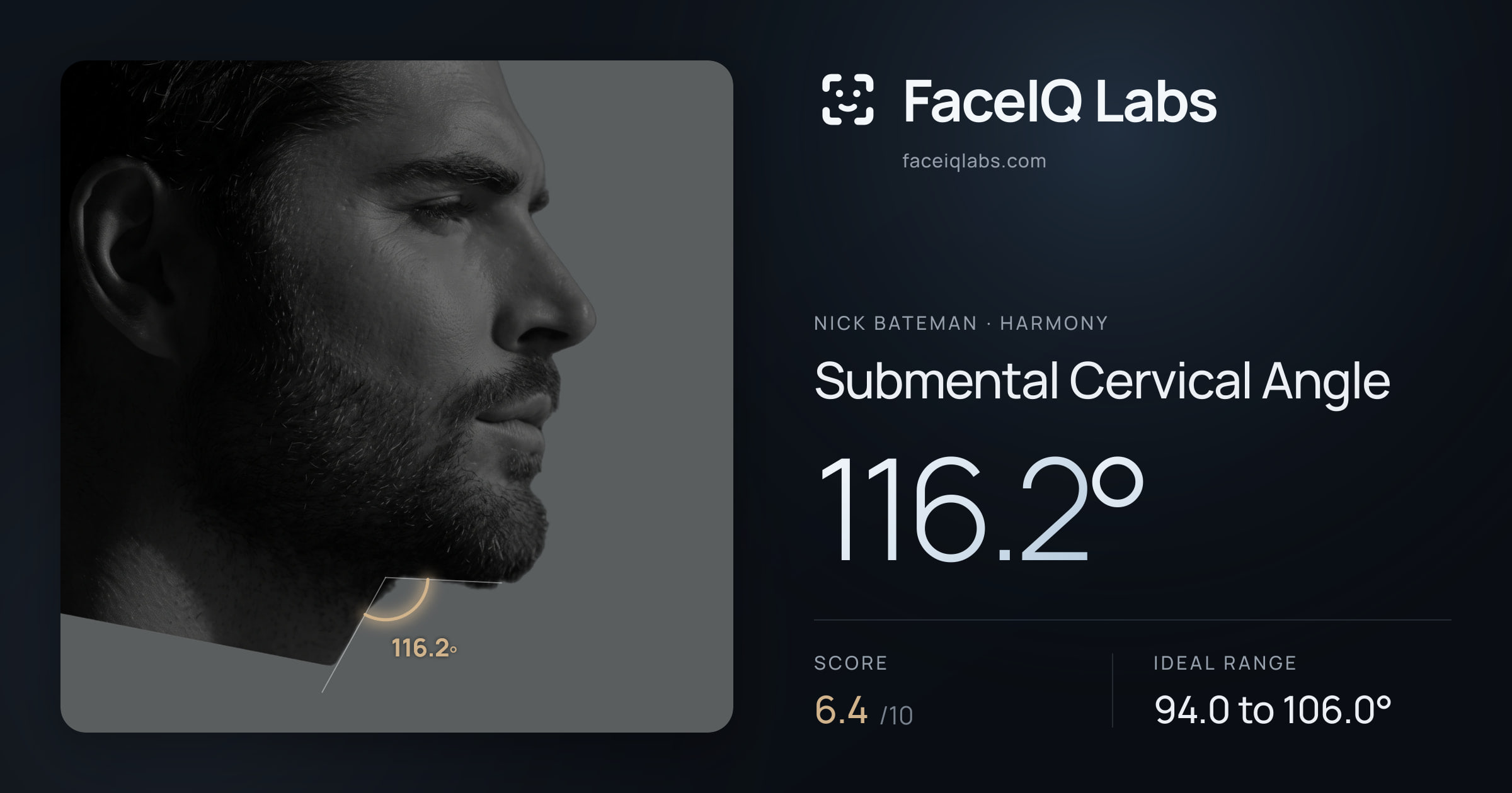 Nick Bateman Submental Cervical Angle: 116.2°, drawn on the photo