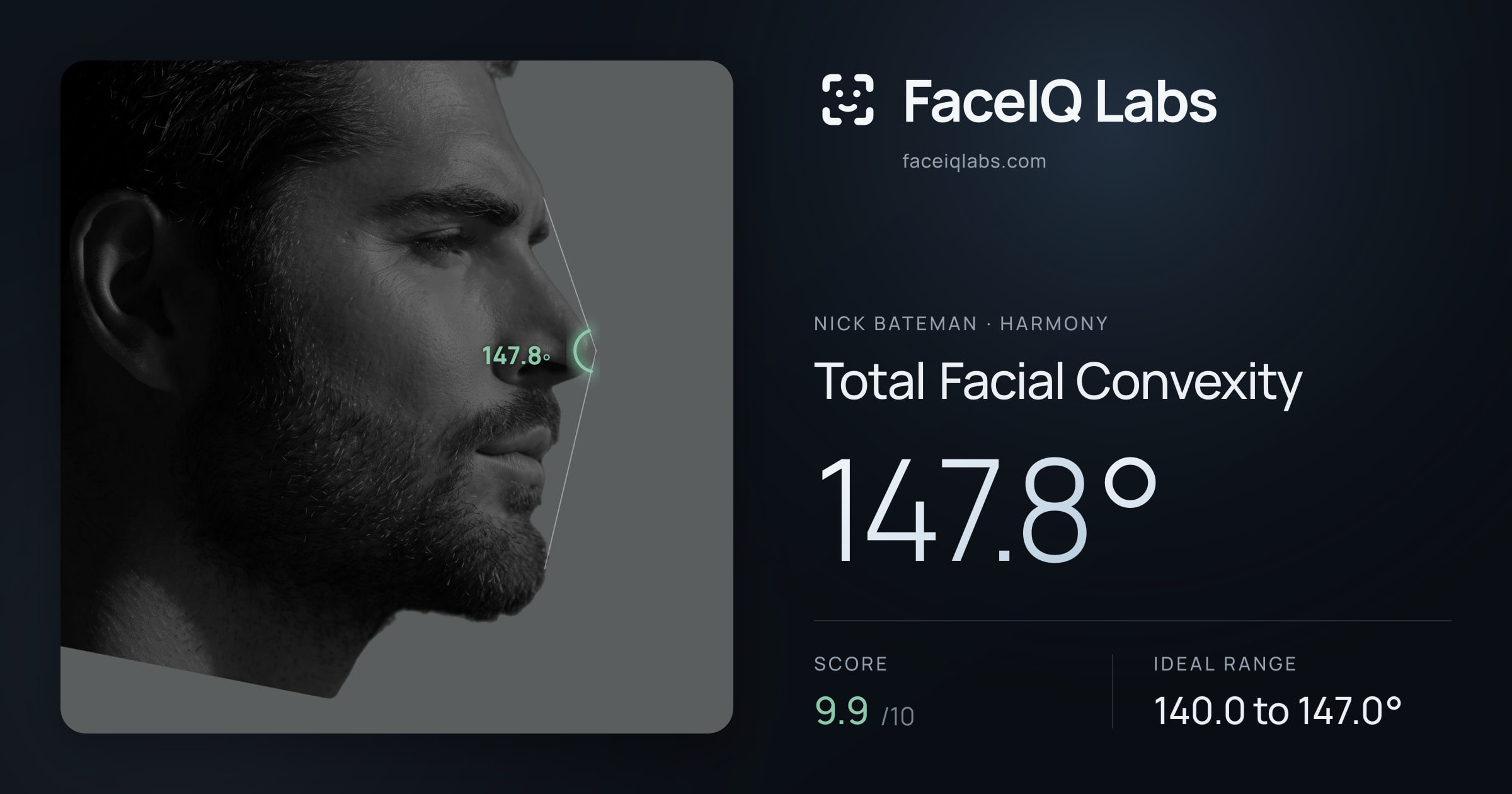 Nick Bateman Total Facial Convexity: 147.8°, drawn on the photo