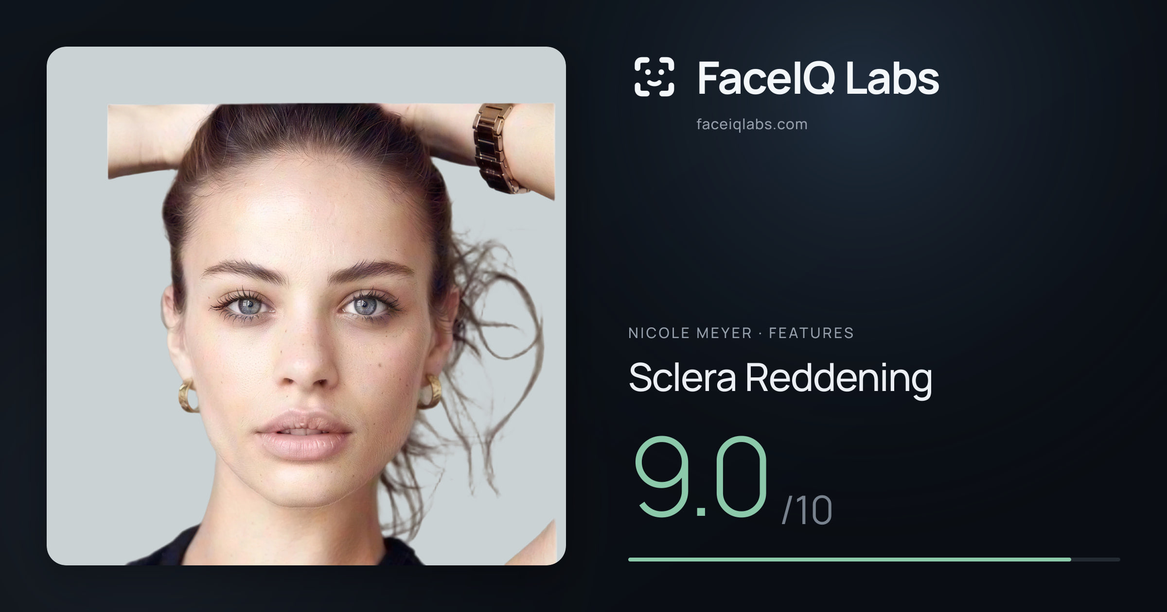 Nicole Meyer Sclera Reddening: 9.0/10, drawn on the photo