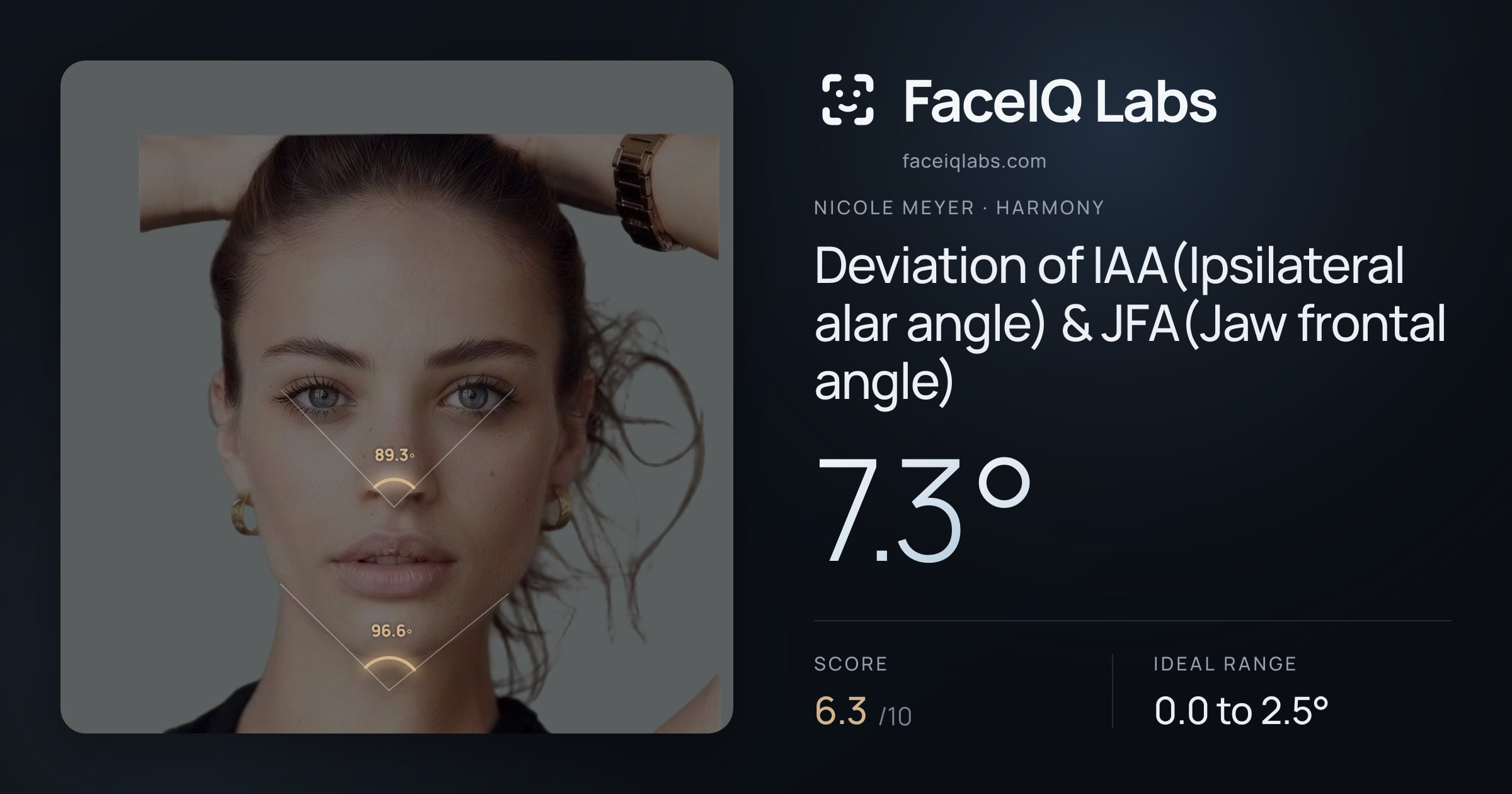 Nicole Meyer Deviation of IAA(Ipsilateral alar angle) & JFA(Jaw frontal angle): 7.3°, drawn on the photo
