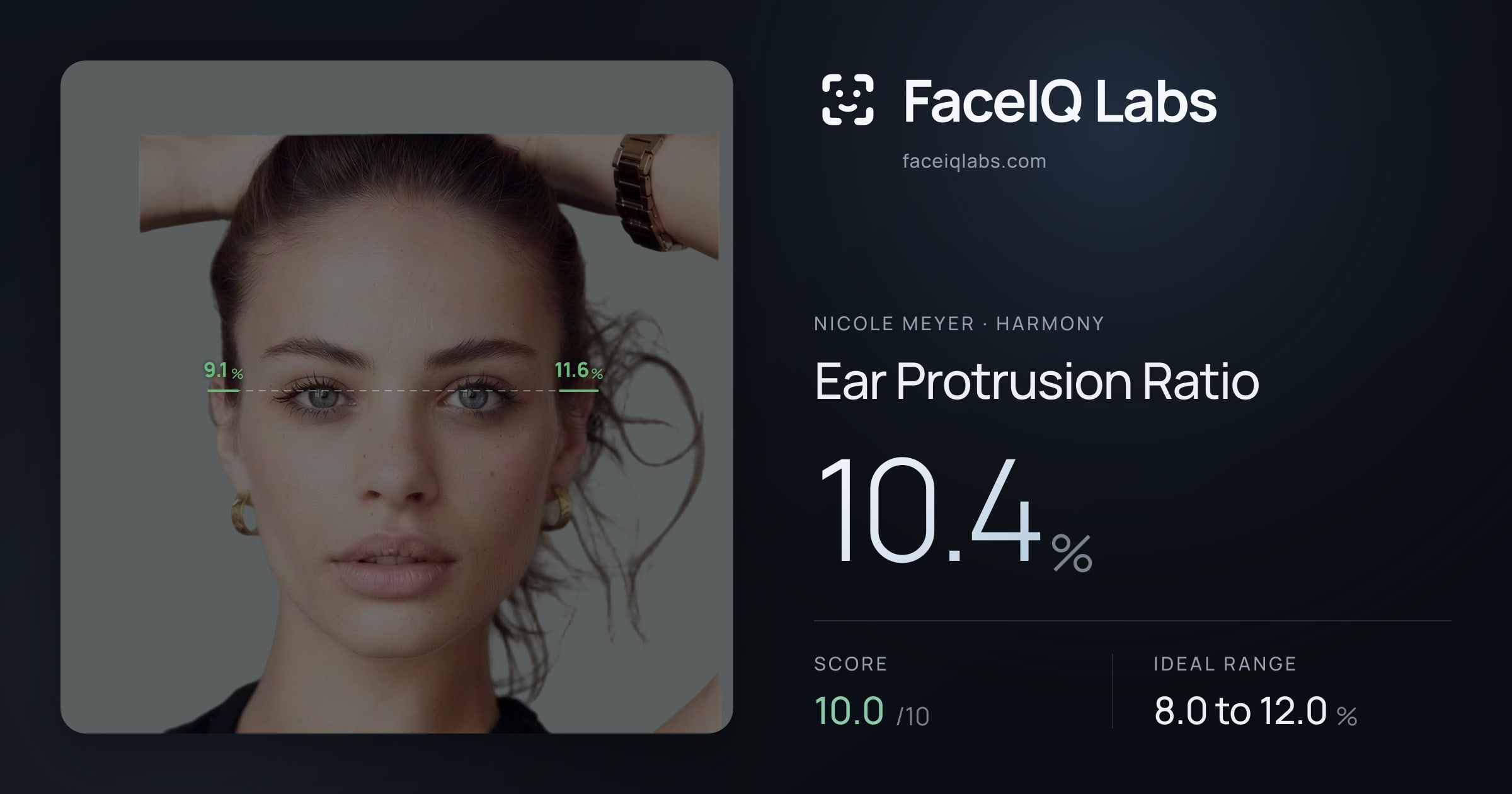 Nicole Meyer Ear Protrusion Ratio: 10.4%, drawn on the photo