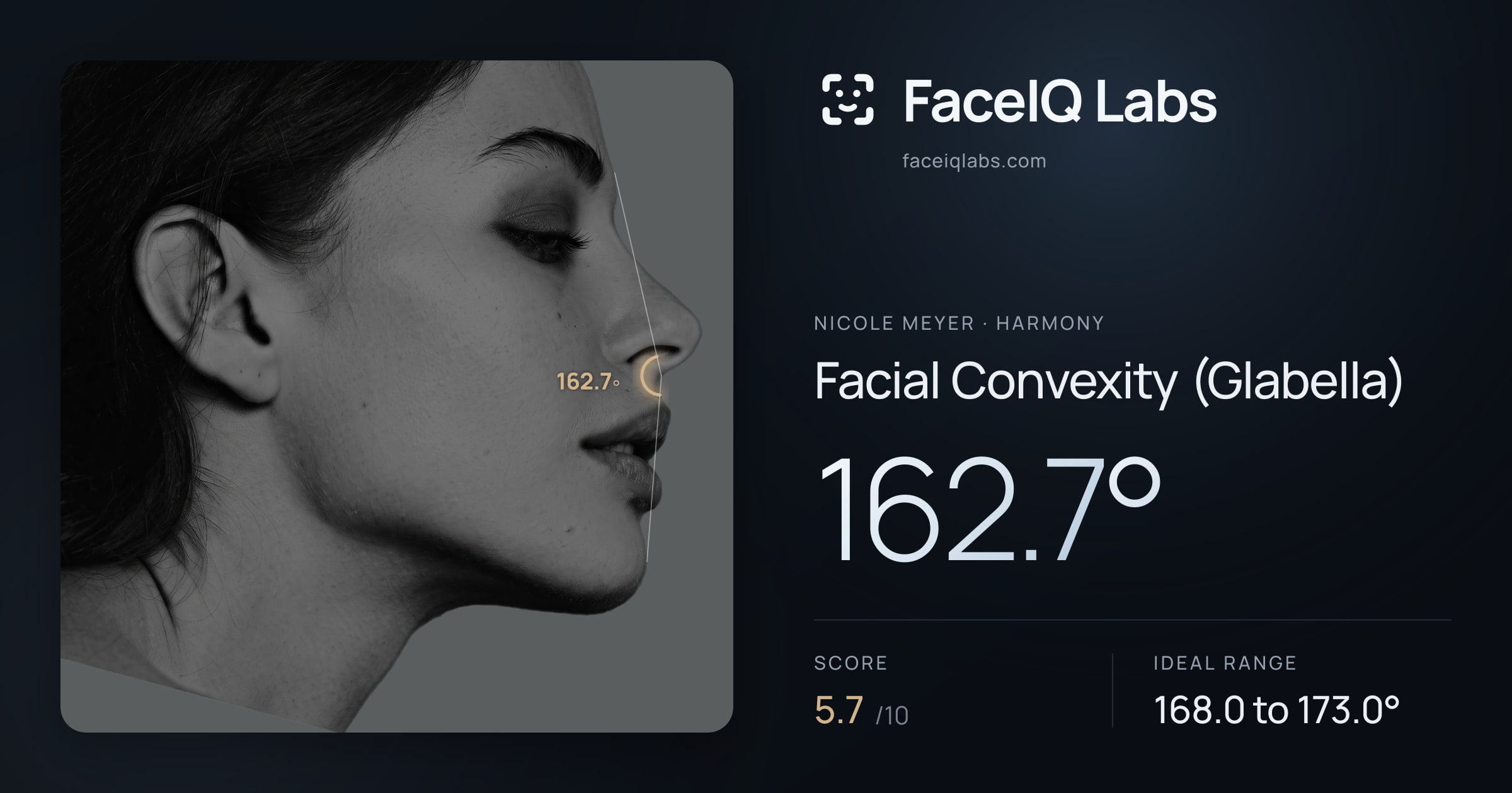 Nicole Meyer Facial Convexity (Glabella): 162.7°, drawn on the photo