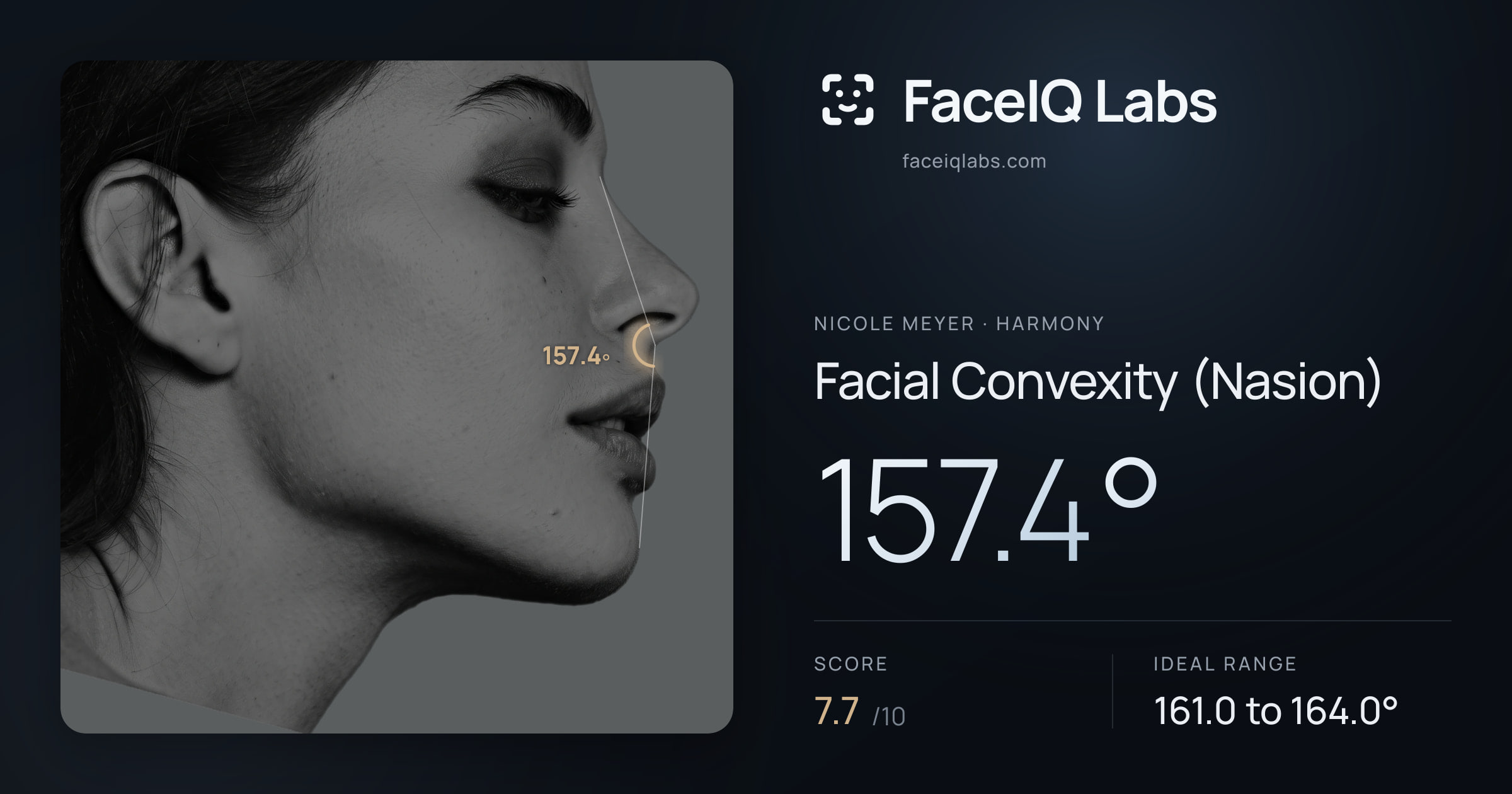 Nicole Meyer Facial Convexity (Nasion): 157.4°, drawn on the photo