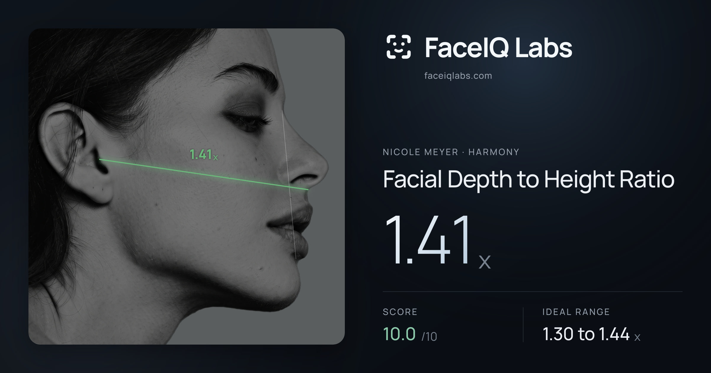 Nicole Meyer Facial Depth to Height Ratio: 1.41x, drawn on the photo