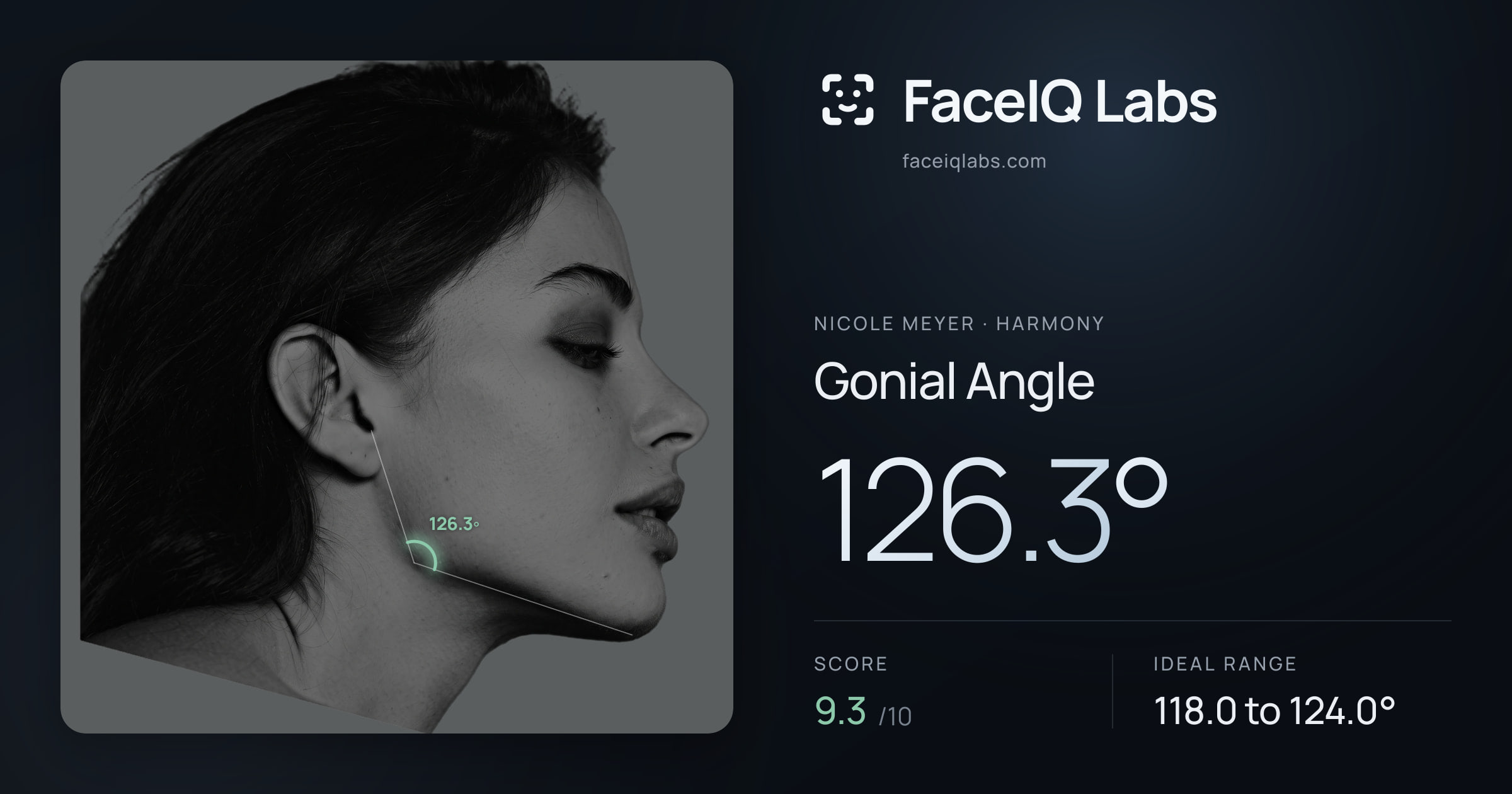 Nicole Meyer Gonial Angle: 126.3°, drawn on the photo