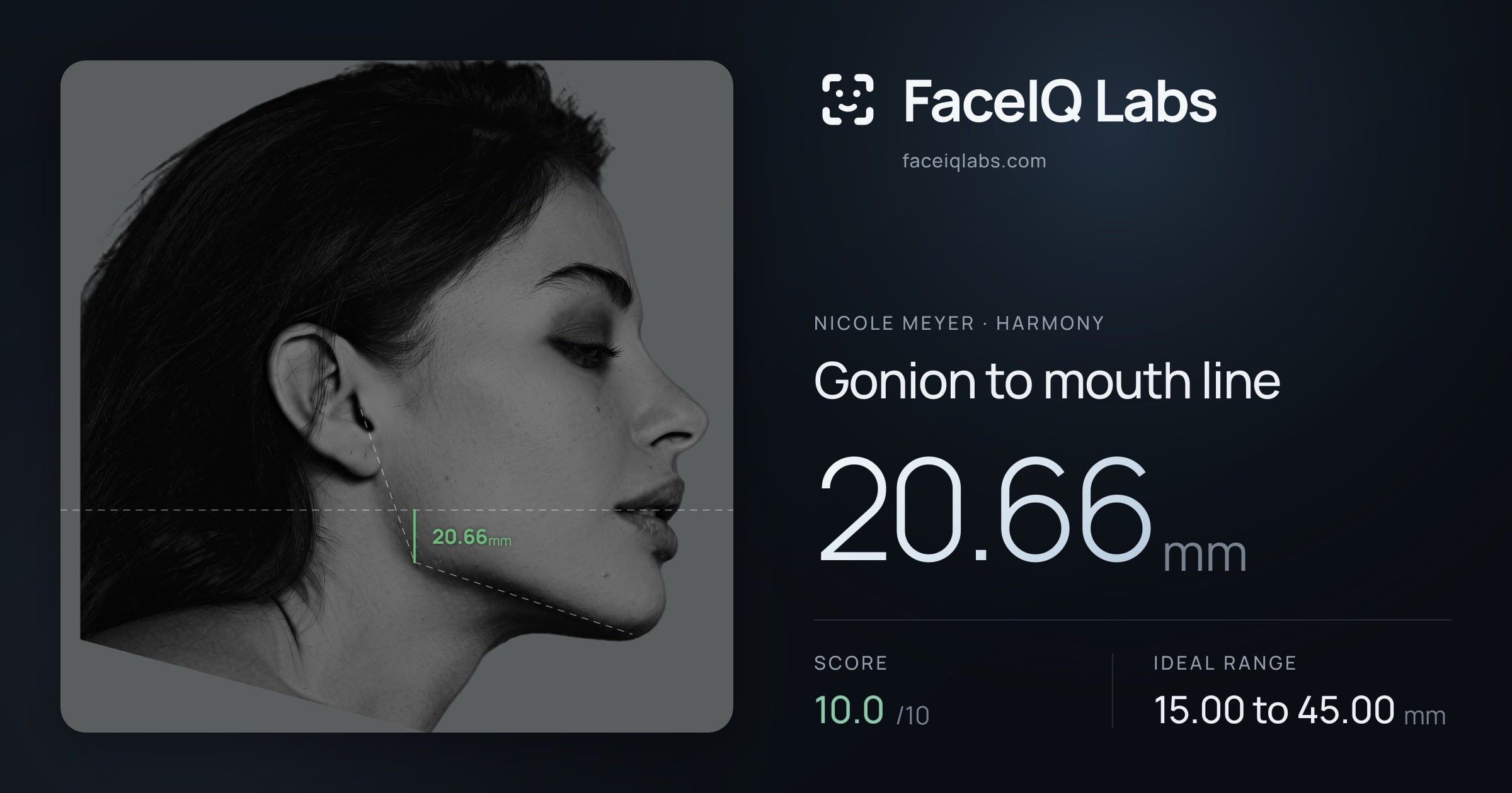 Nicole Meyer Gonion to mouth line: 20.66mm, drawn on the photo