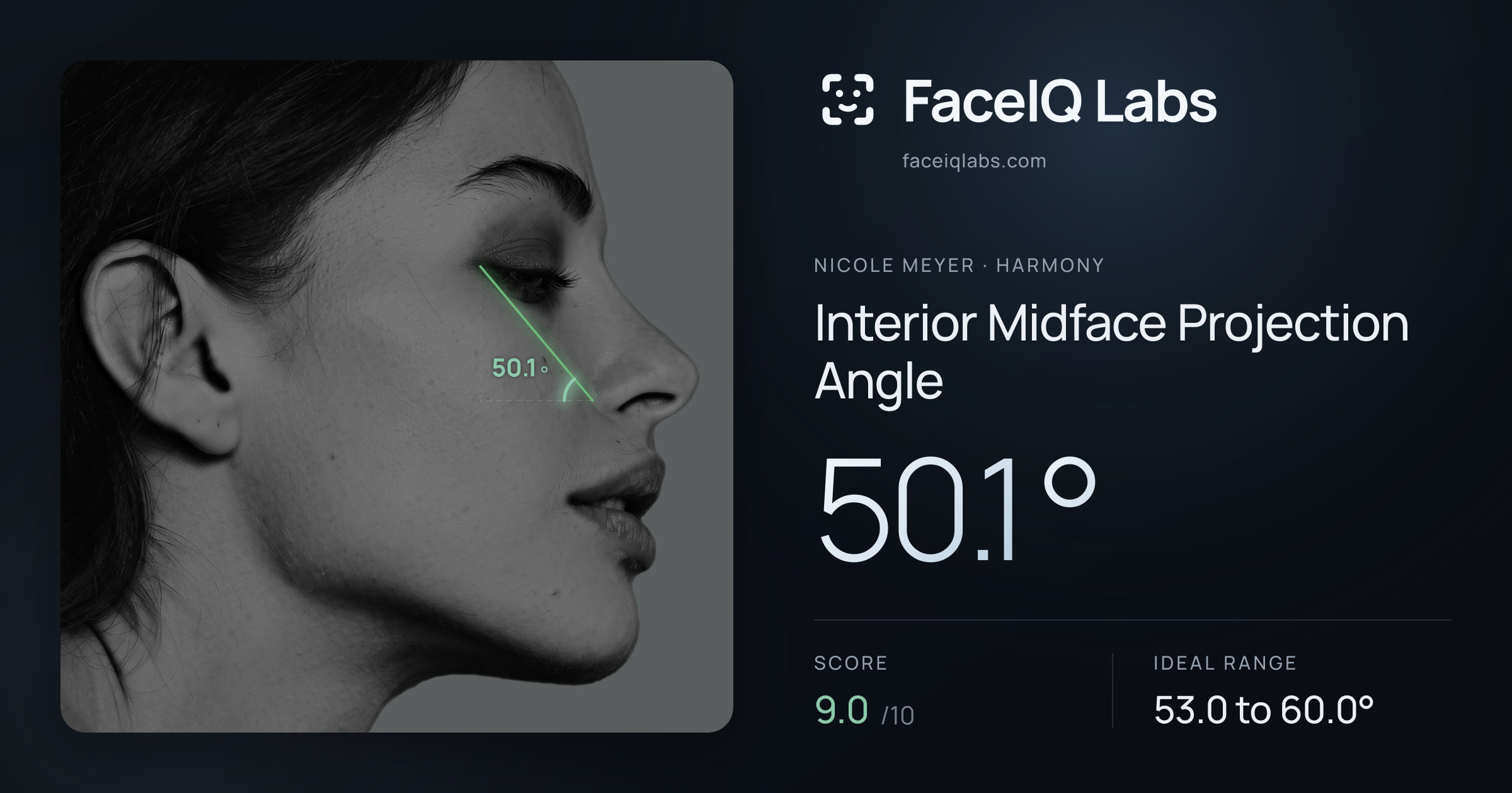 Nicole Meyer Interior Midface Projection Angle: 50.1°, drawn on the photo