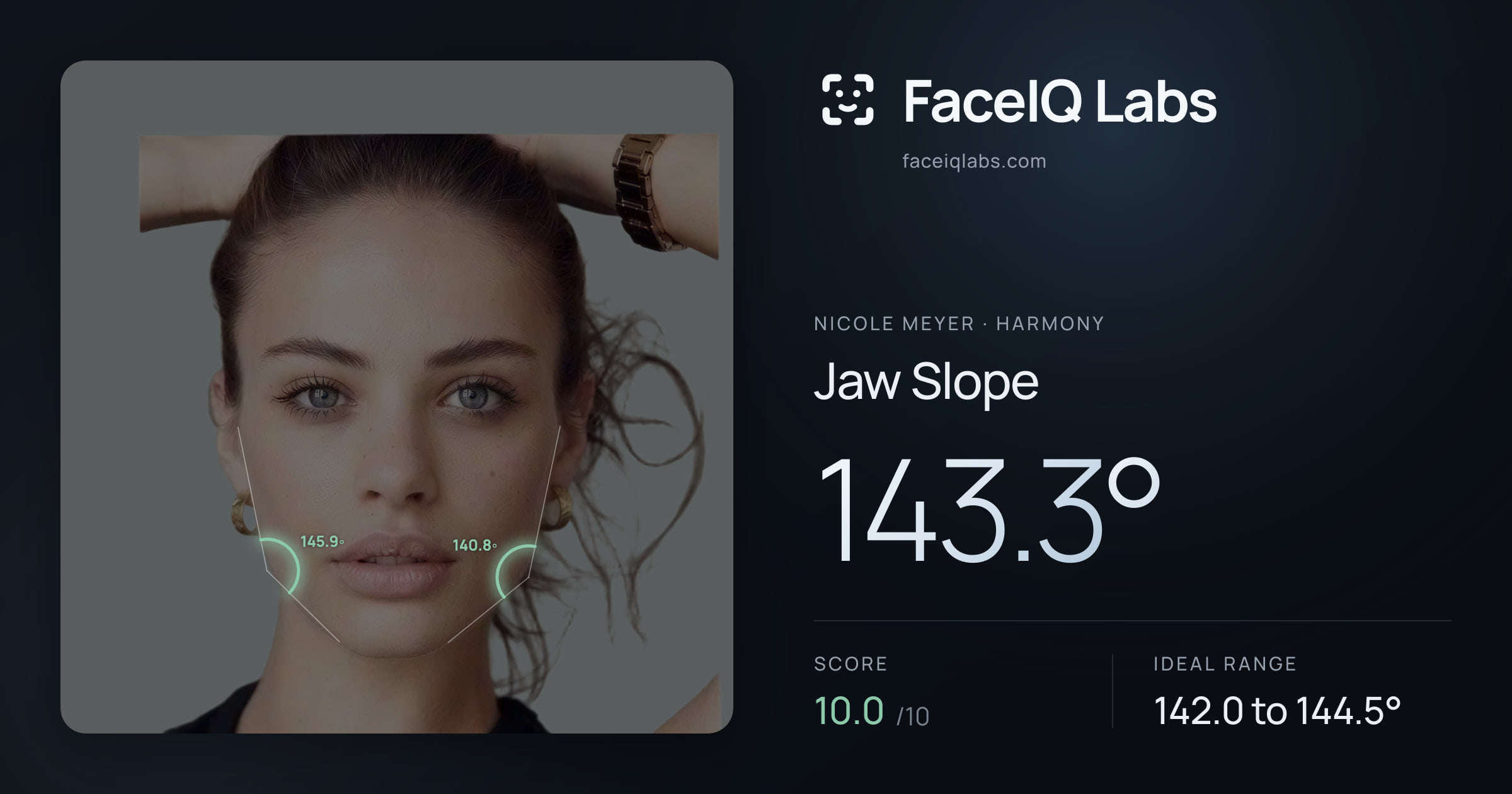 Nicole Meyer Jaw Slope: 143.3°, drawn on the photo