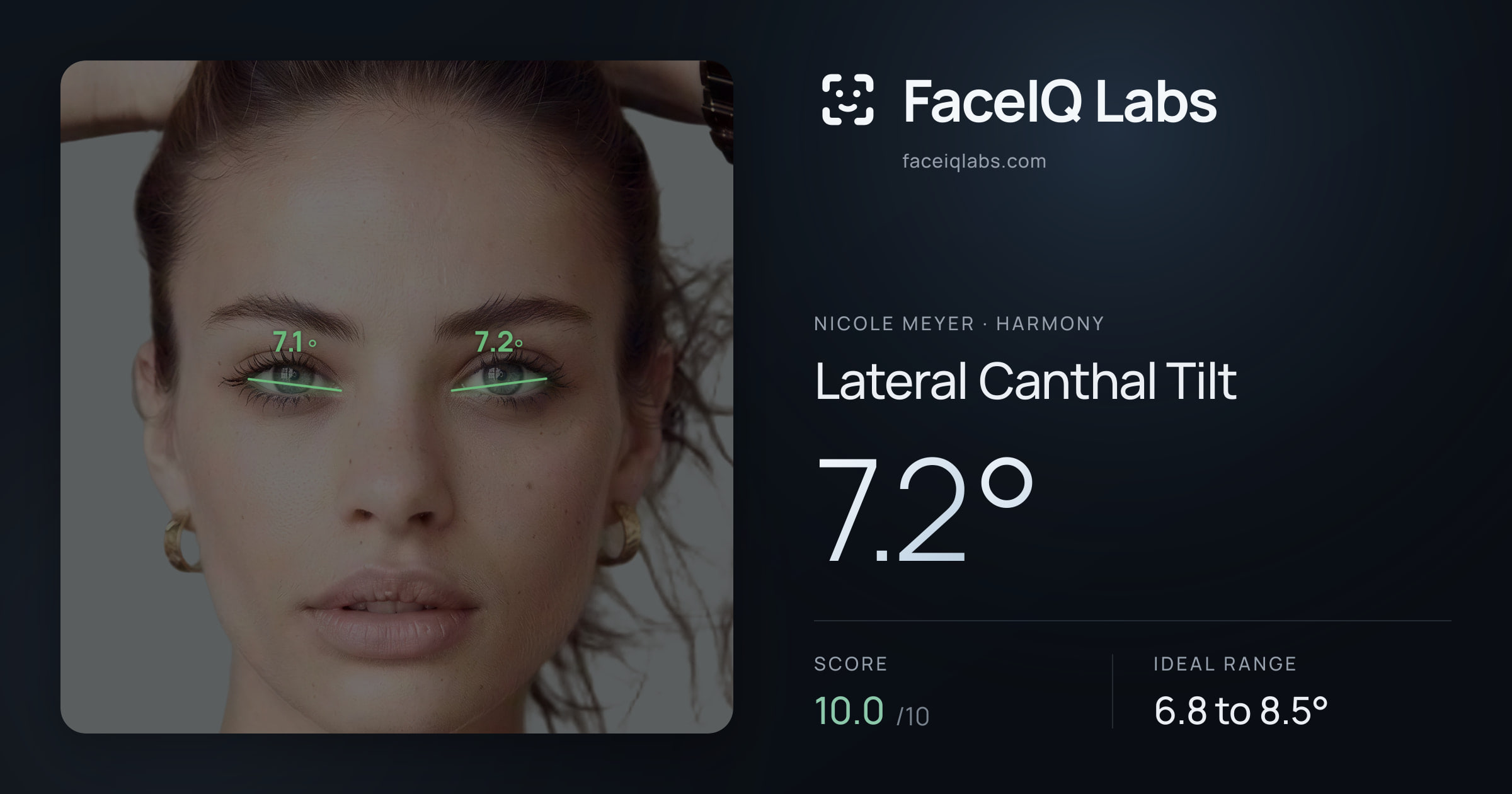 Nicole Meyer Lateral Canthal Tilt: 7.2°, drawn on the photo