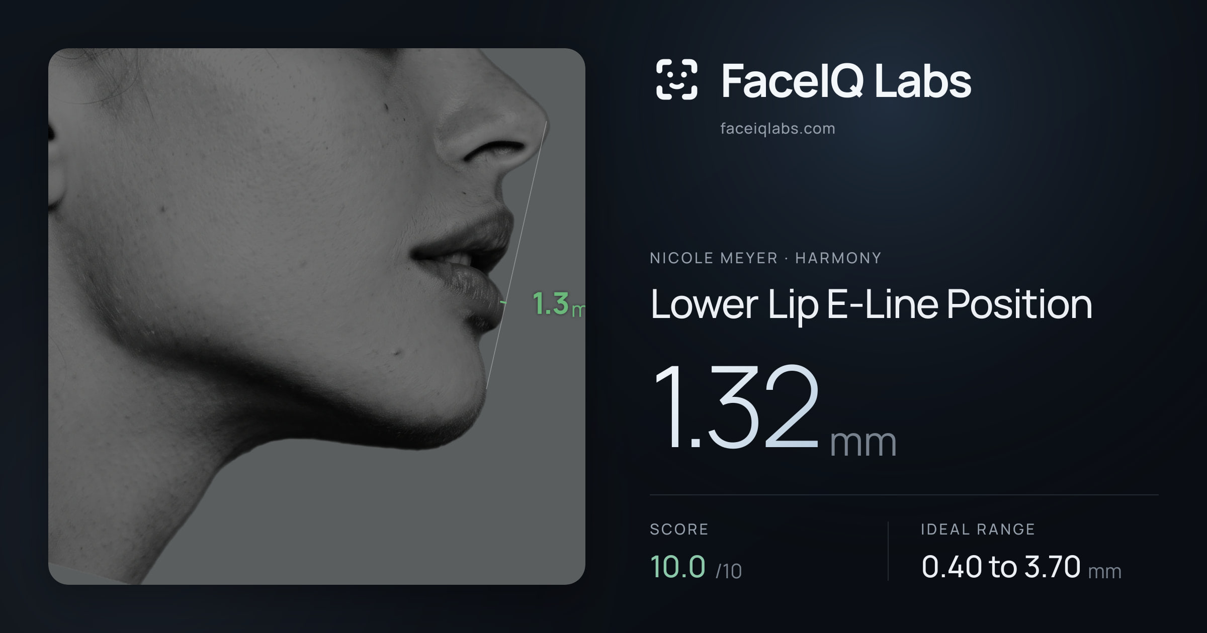 Nicole Meyer Lower Lip E-Line Position: 1.32mm, drawn on the photo