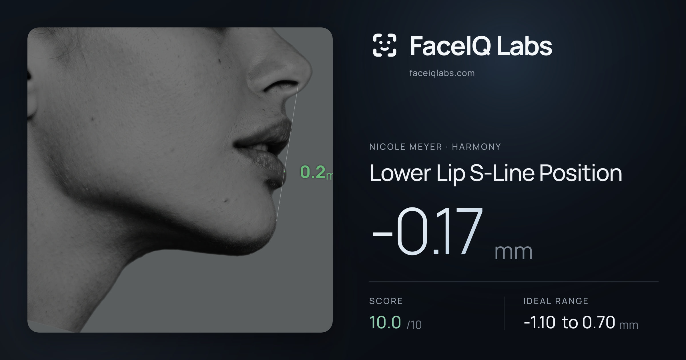 Nicole Meyer Lower Lip S-Line Position: -0.17mm, drawn on the photo