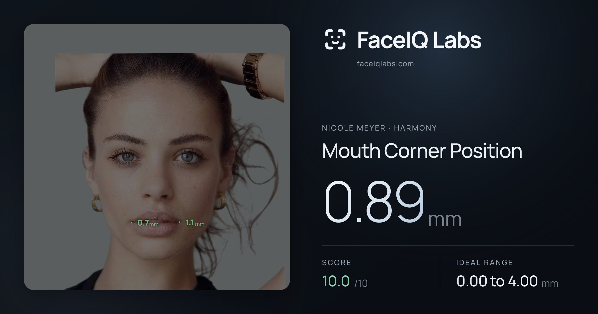 Nicole Meyer Mouth Corner Position: 0.89mm, drawn on the photo