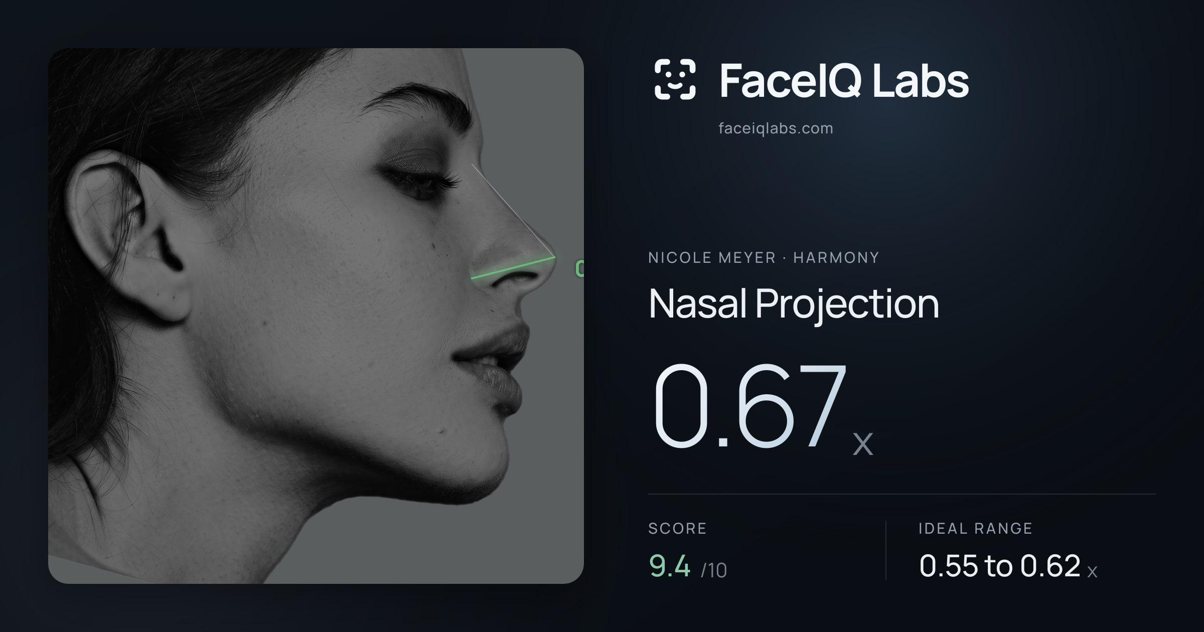 Nicole Meyer Nasal Projection: 0.67x, drawn on the photo