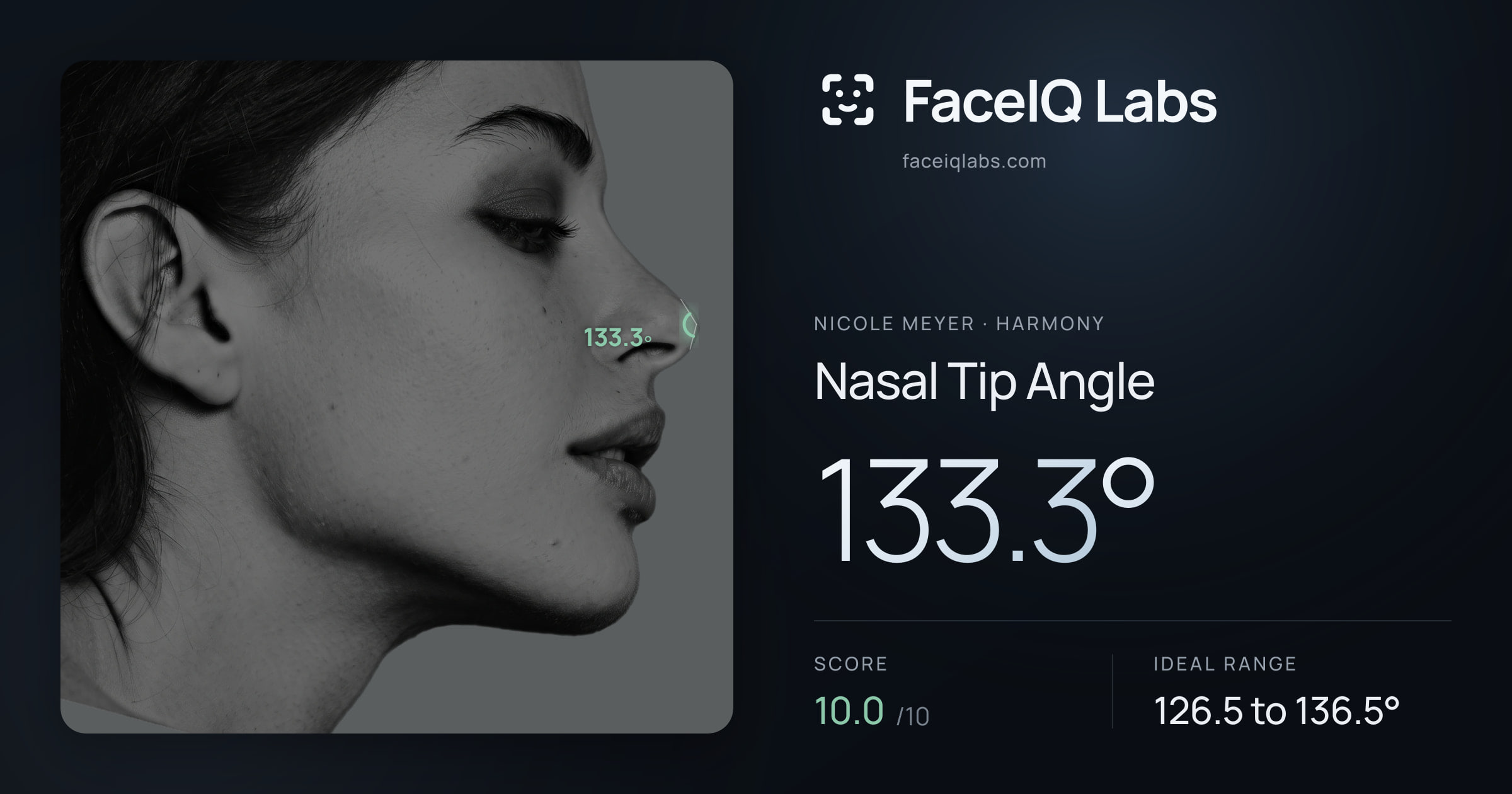 Nicole Meyer Nasal Tip Angle: 133.3°, drawn on the photo