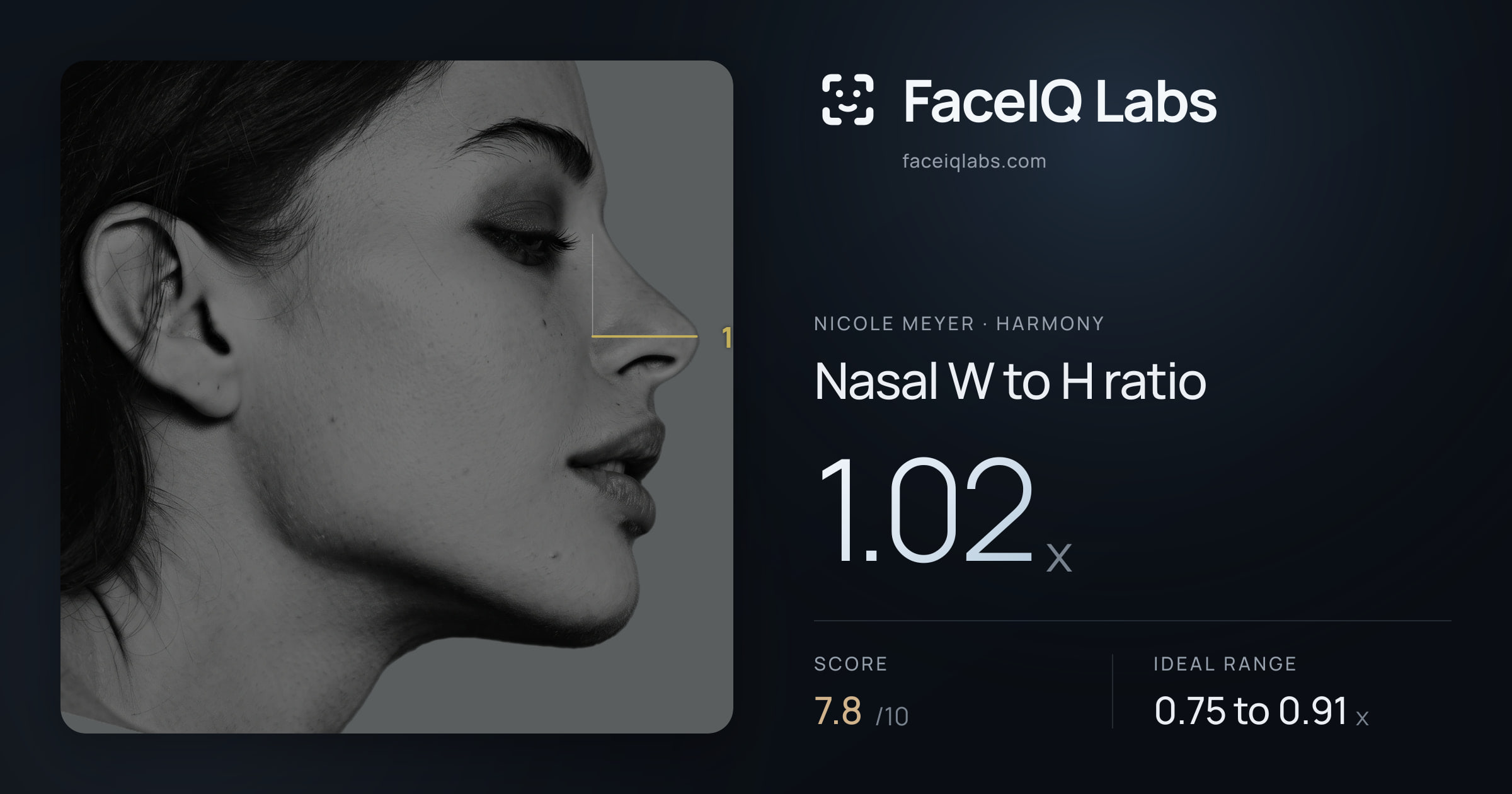 Nicole Meyer Nasal W to H ratio: 1.02x, drawn on the photo