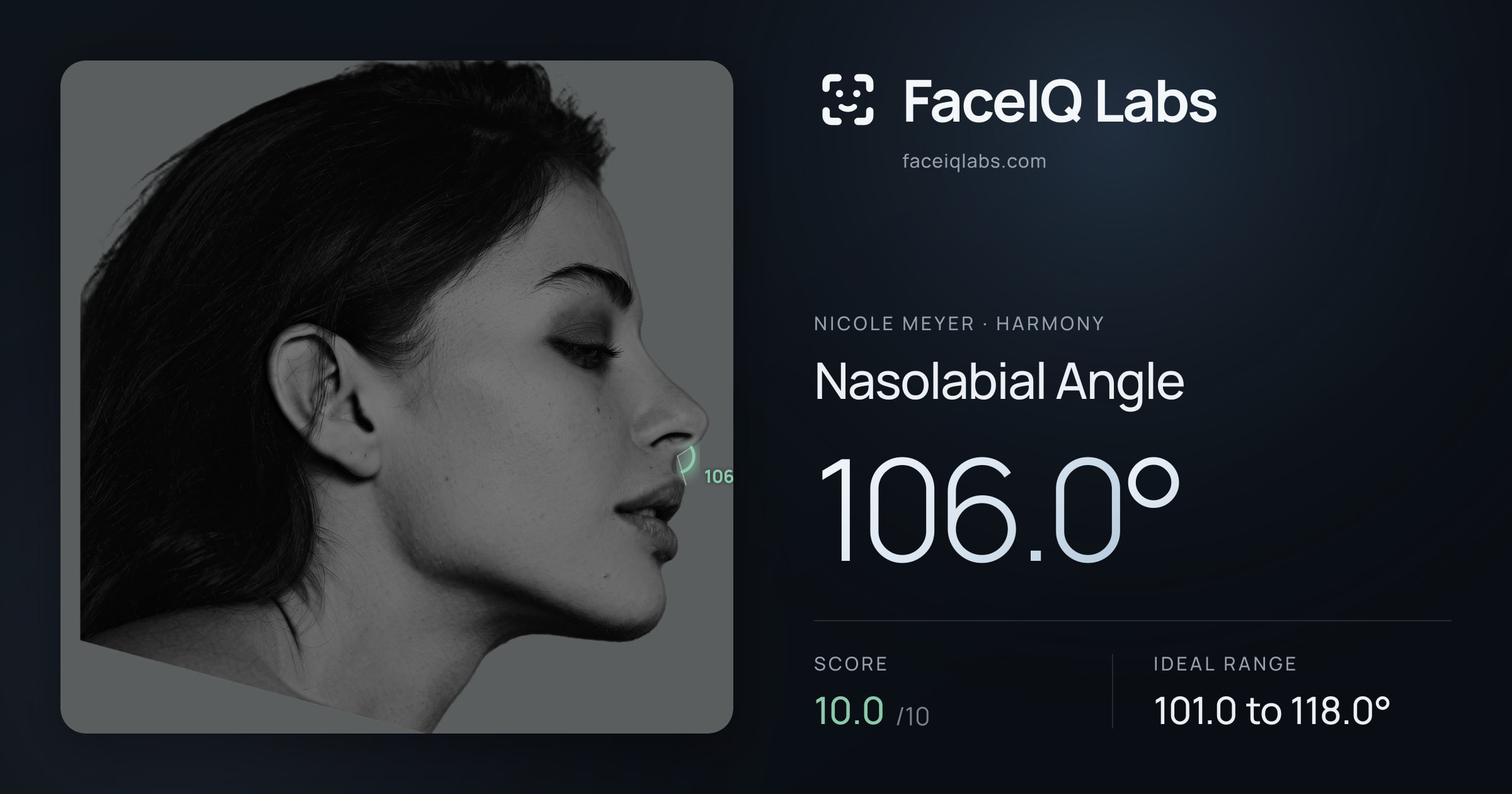 Nicole Meyer Nasolabial Angle: 106.0°, drawn on the photo