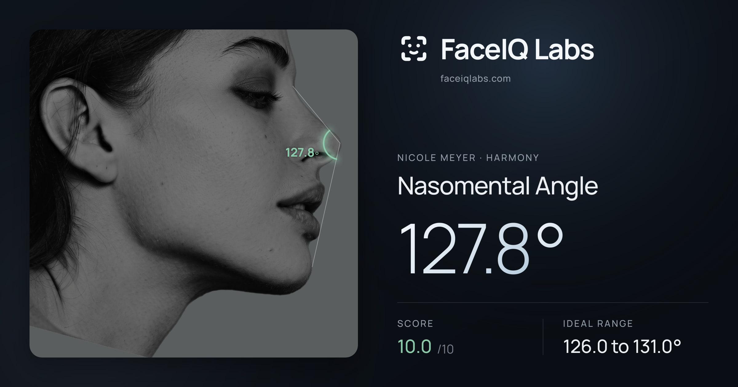 Nicole Meyer Nasomental Angle: 127.8°, drawn on the photo