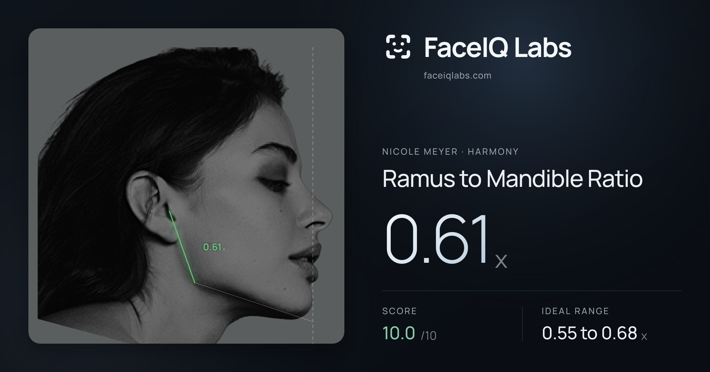 Nicole Meyer Ramus to Mandible Ratio: 0.61x, drawn on the photo