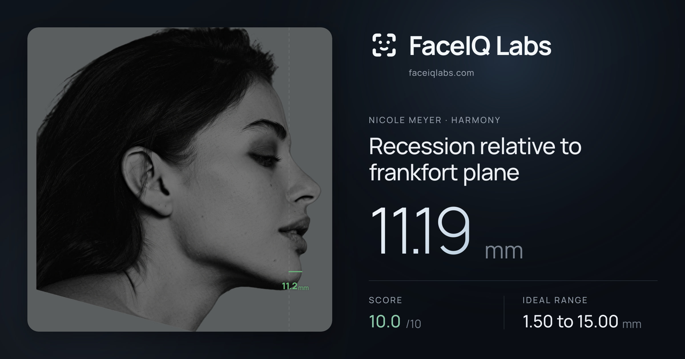 Nicole Meyer Recession relative to frankfort plane: 11.19mm, drawn on the photo