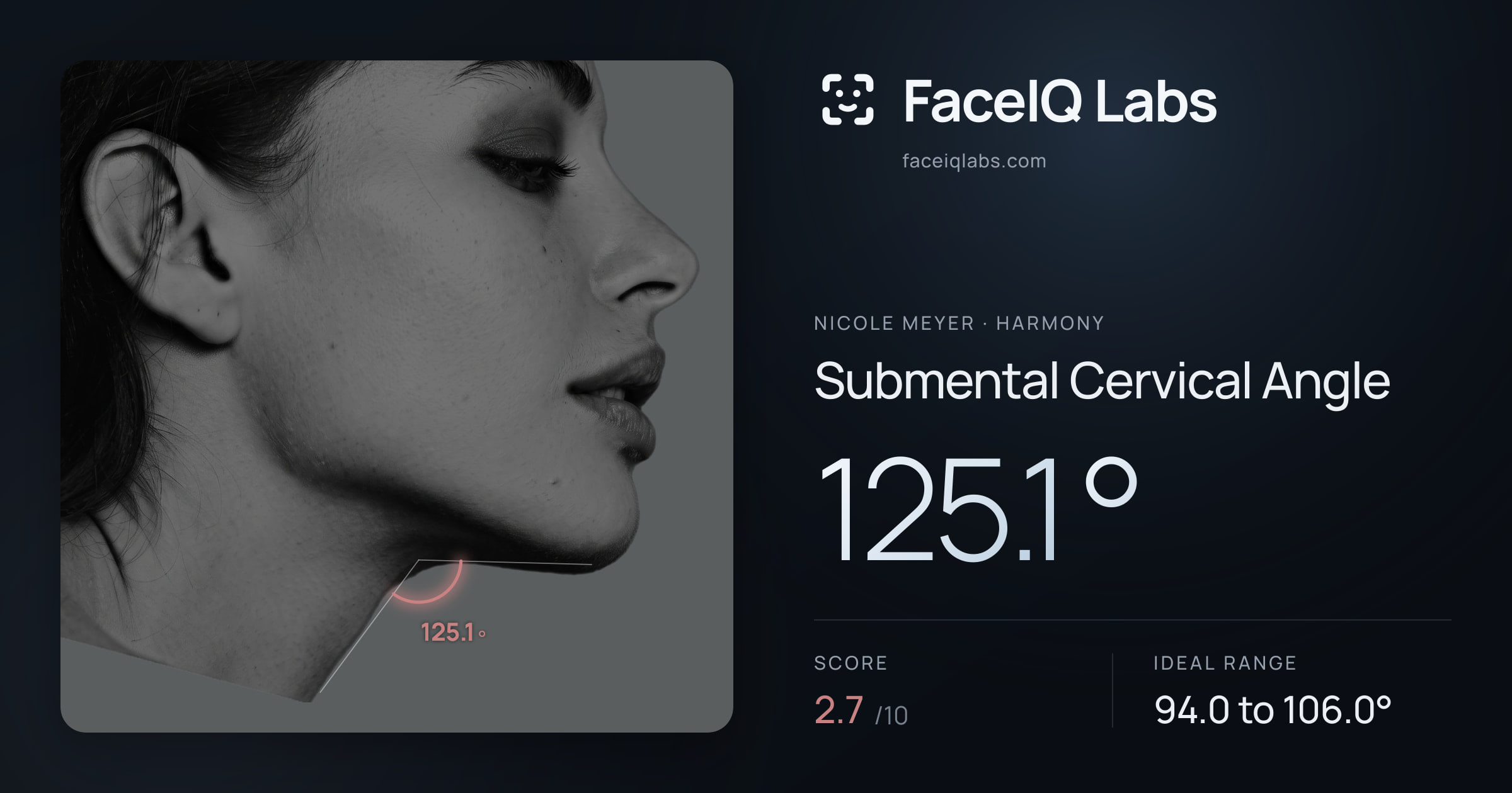 Nicole Meyer Submental Cervical Angle: 125.1°, drawn on the photo
