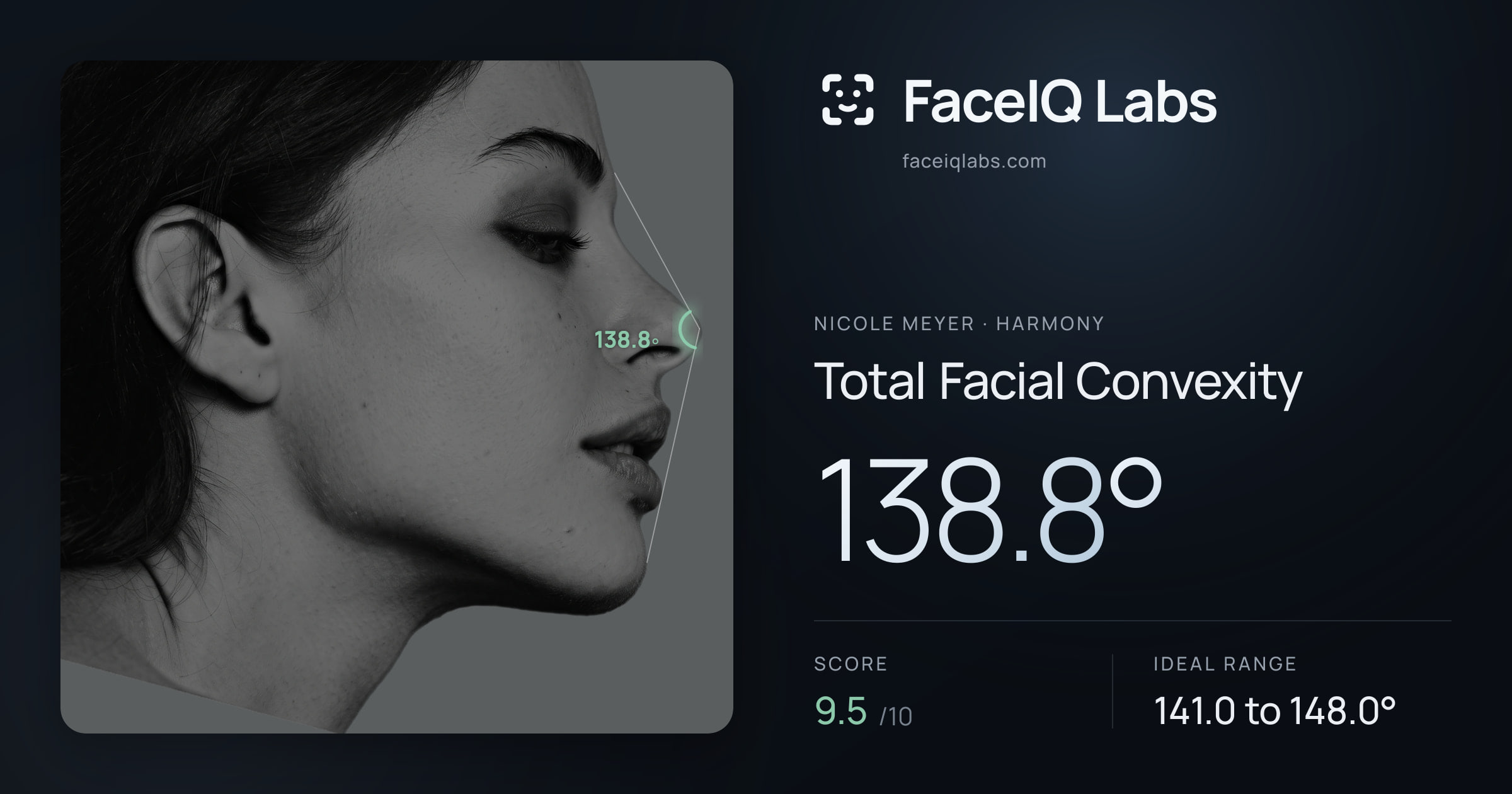 Nicole Meyer Total Facial Convexity: 138.8°, drawn on the photo