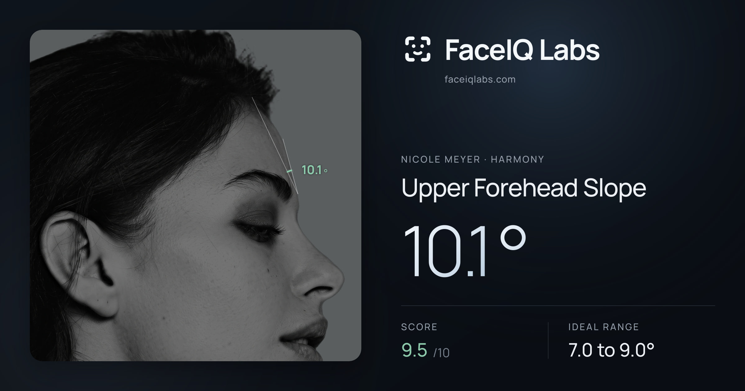 Nicole Meyer Upper Forehead Slope: 10.1°, drawn on the photo