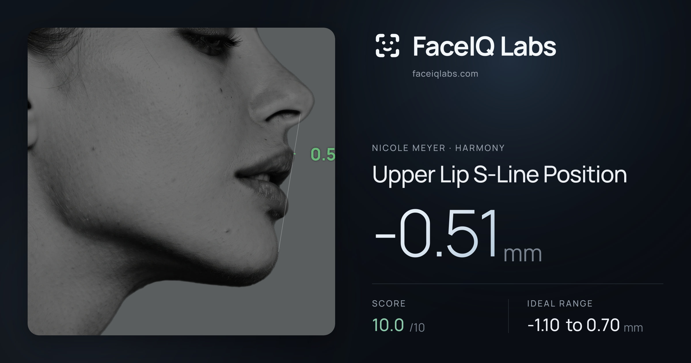 Nicole Meyer Upper Lip S-Line Position: -0.51mm, drawn on the photo
