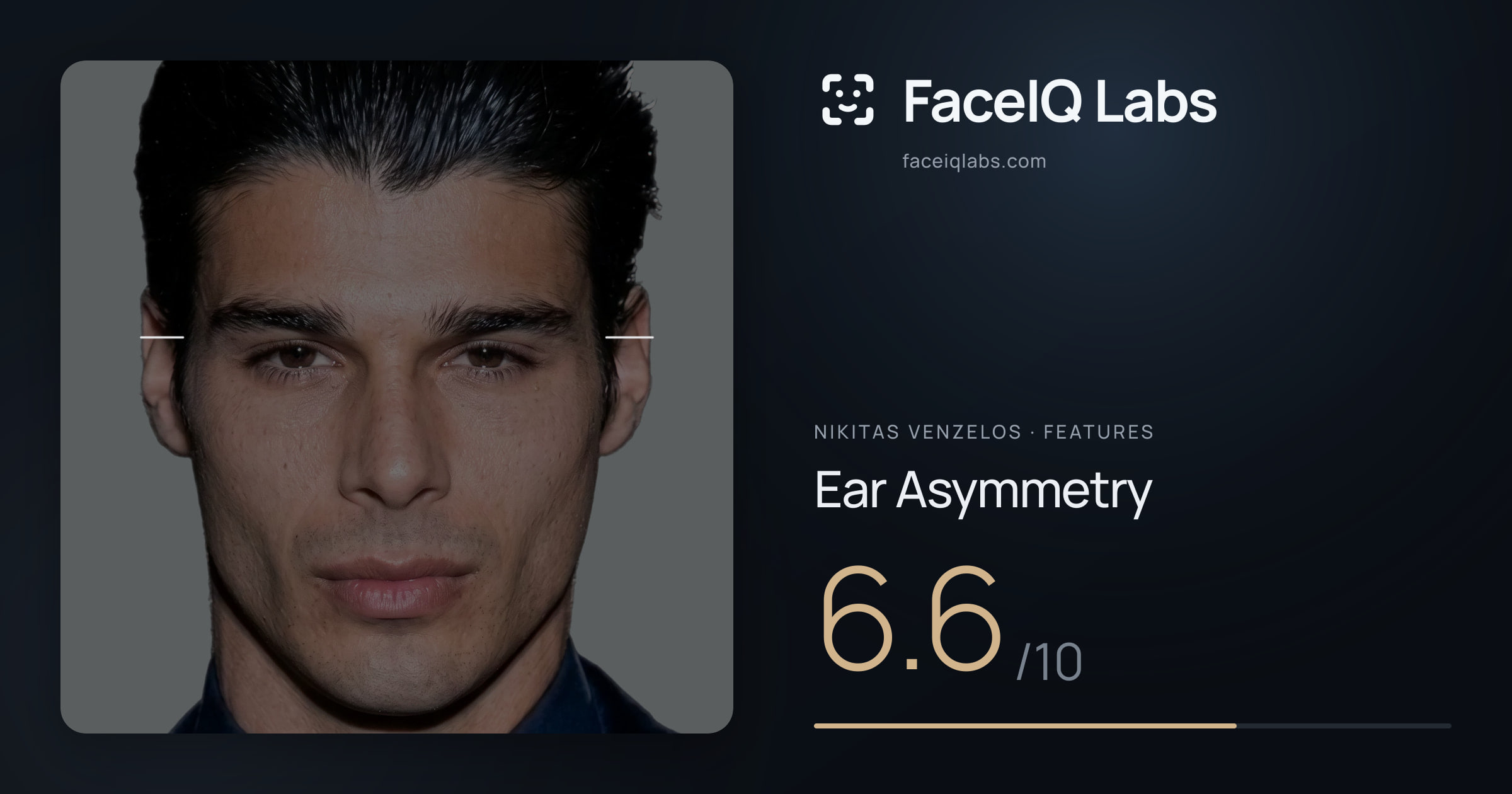 Nikitas Venzelos Ear Asymmetry: 6.6/10, drawn on the photo